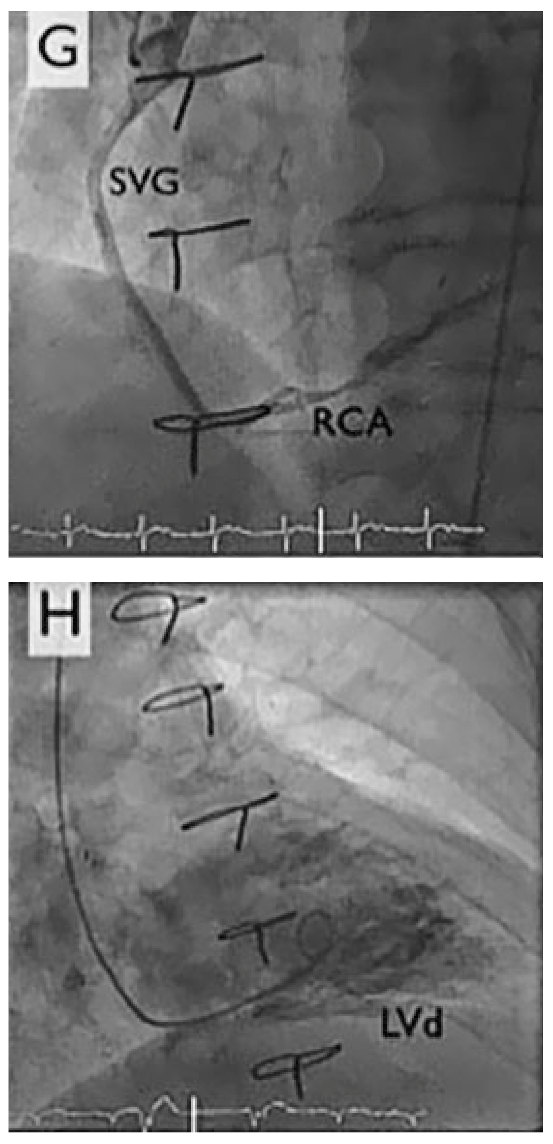 Cardiovascmed 21 00170 g001d