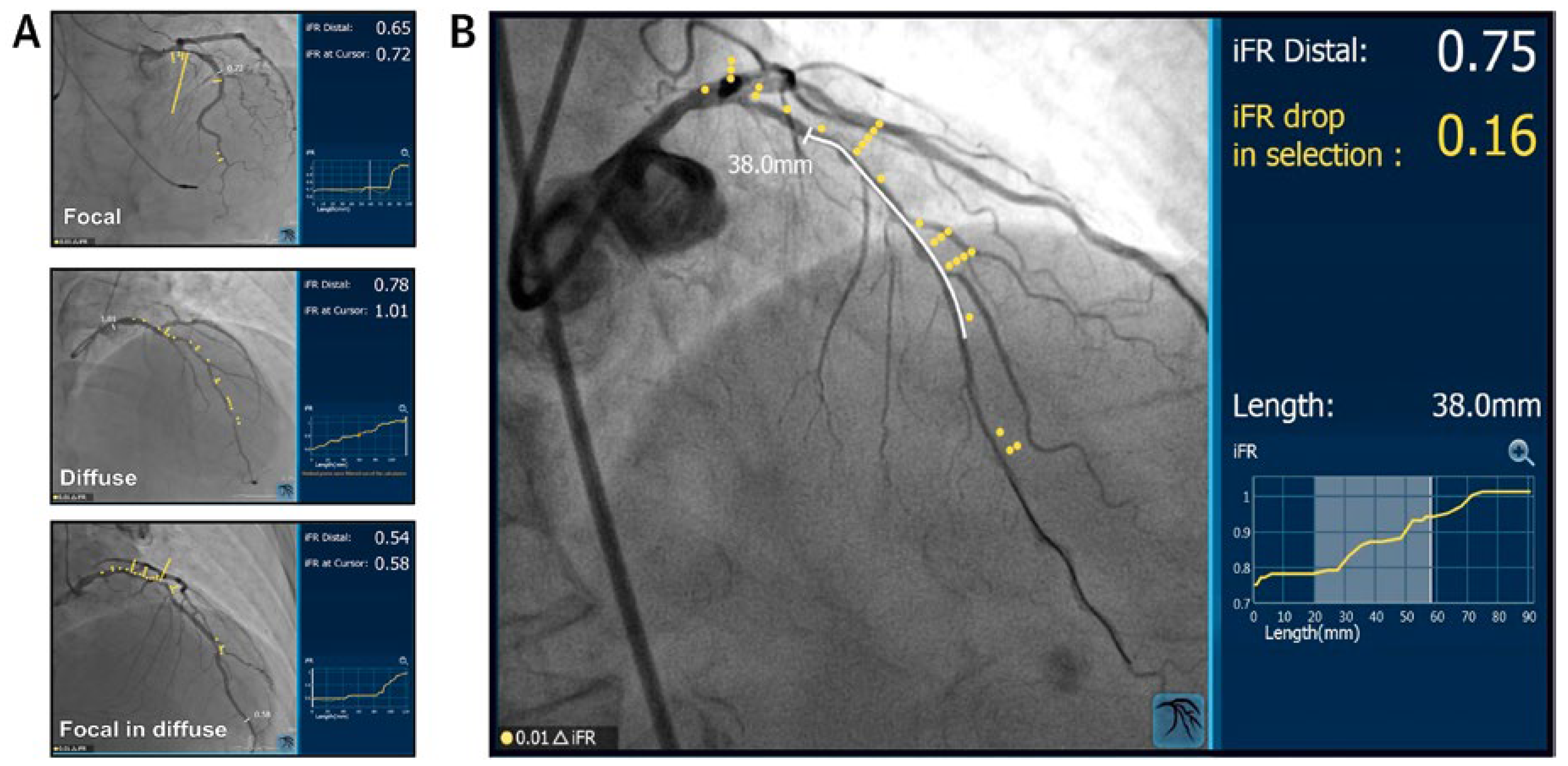 Cardiovascmed 21 00181 g003 Cardiovascmed 21 00181 g003