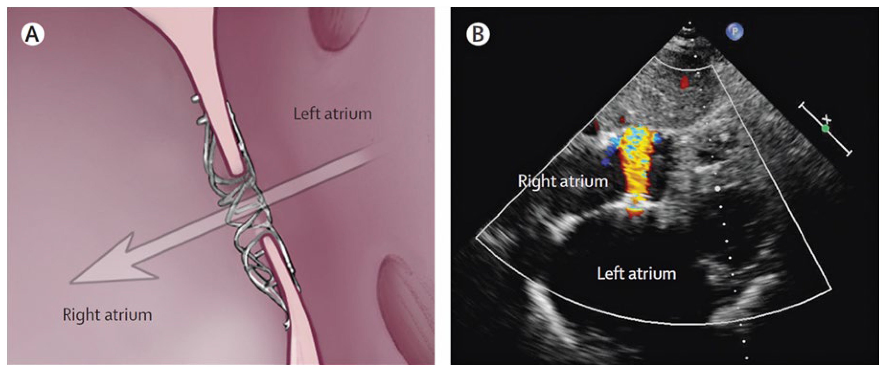 Cardiovascmed 21 00191 g001
