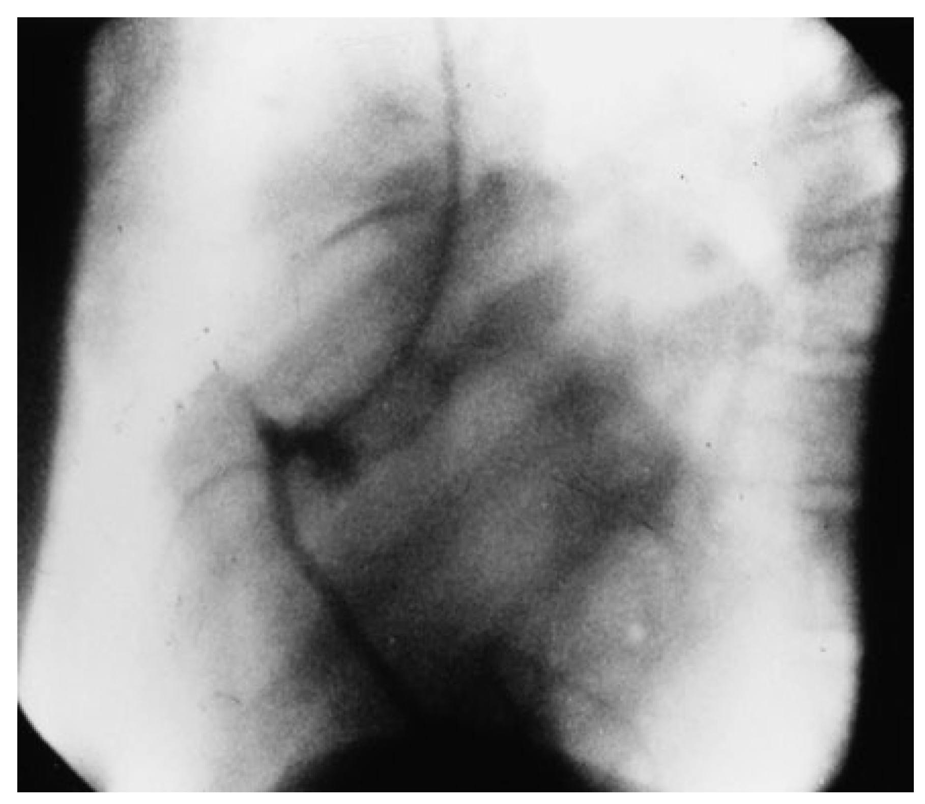 Cardiovascmed 21 00241 g003