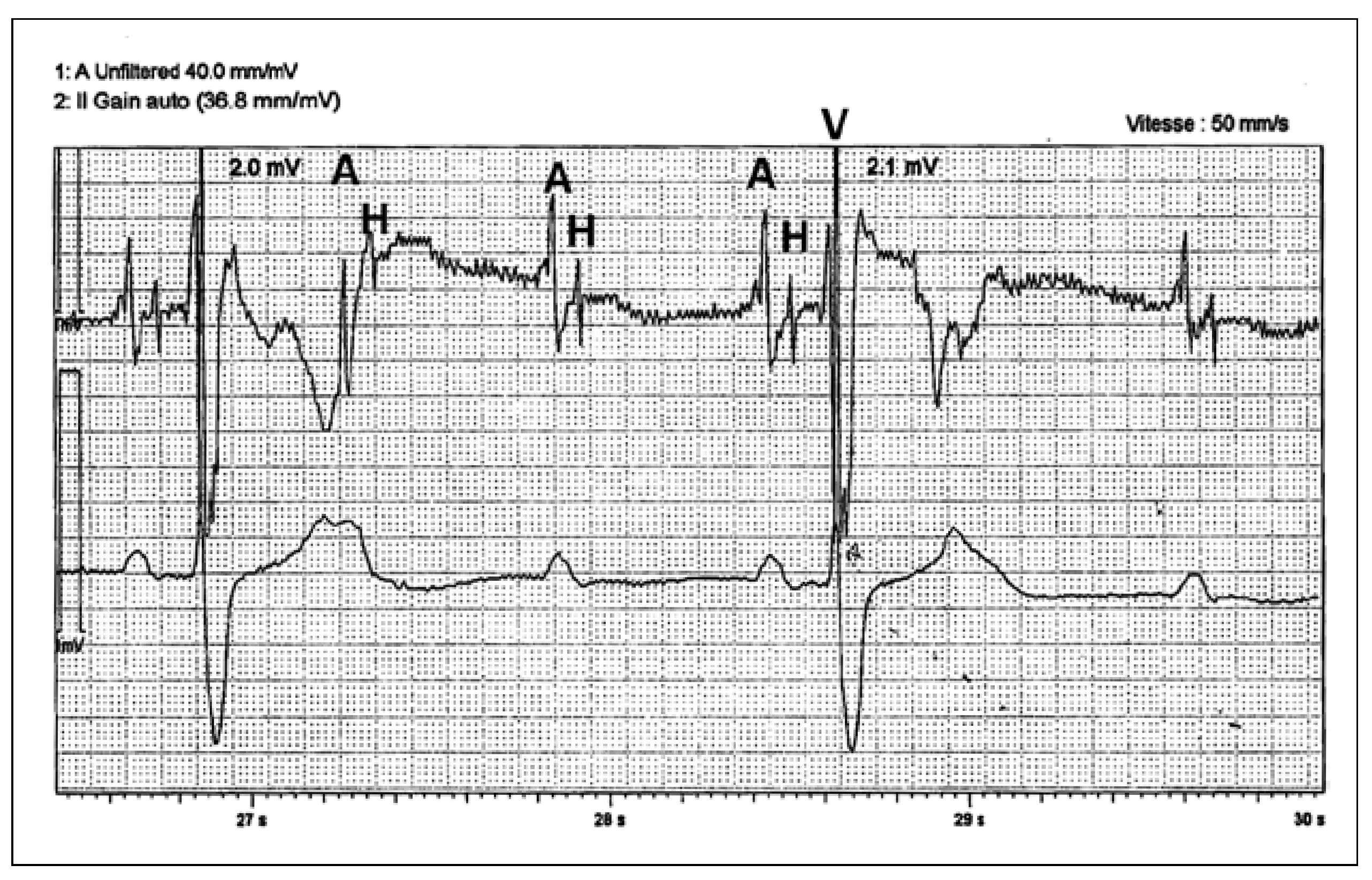Cardiovascmed 21 00249 g002