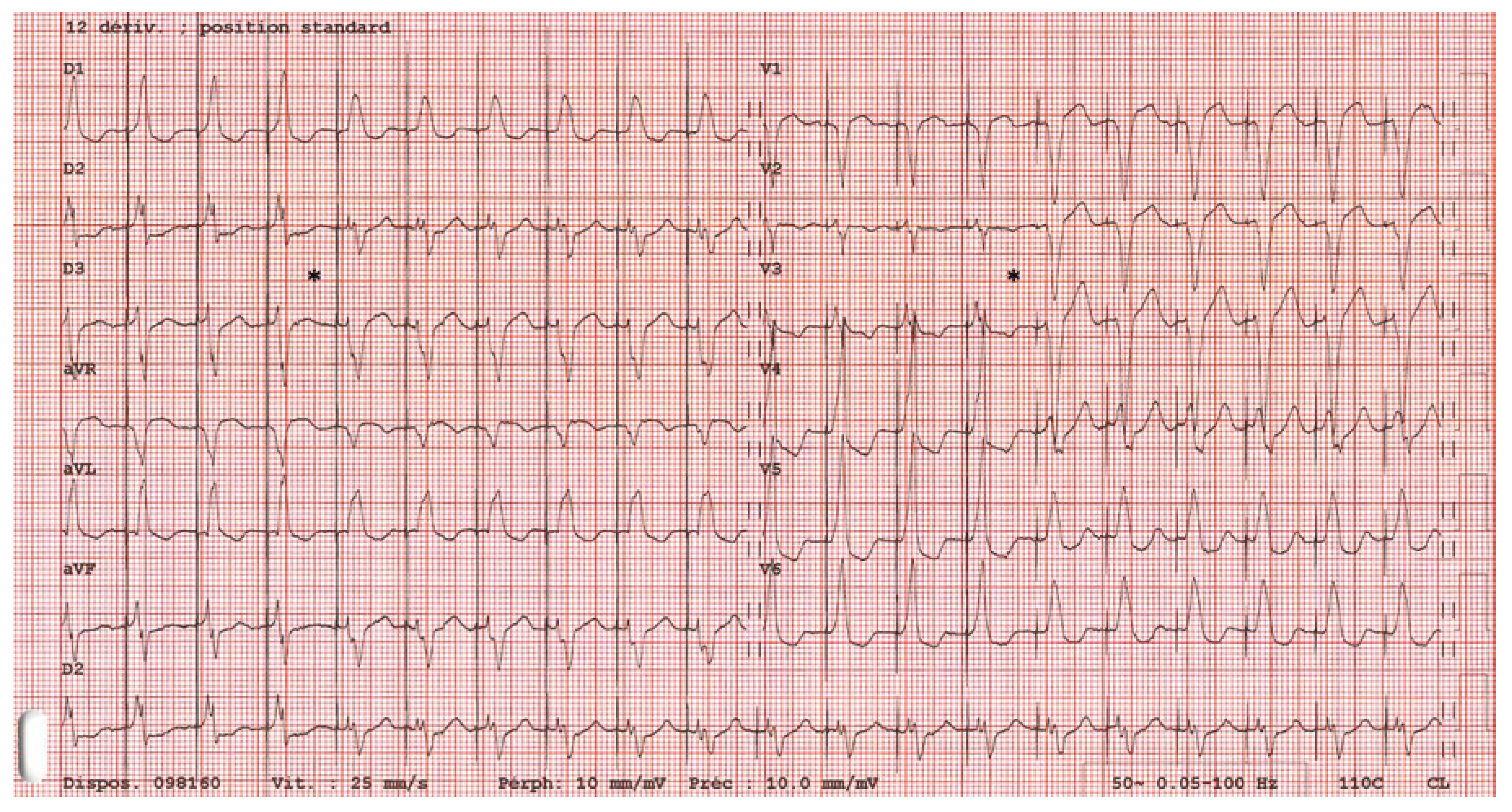 Cardiovascmed 21 00249 g004
