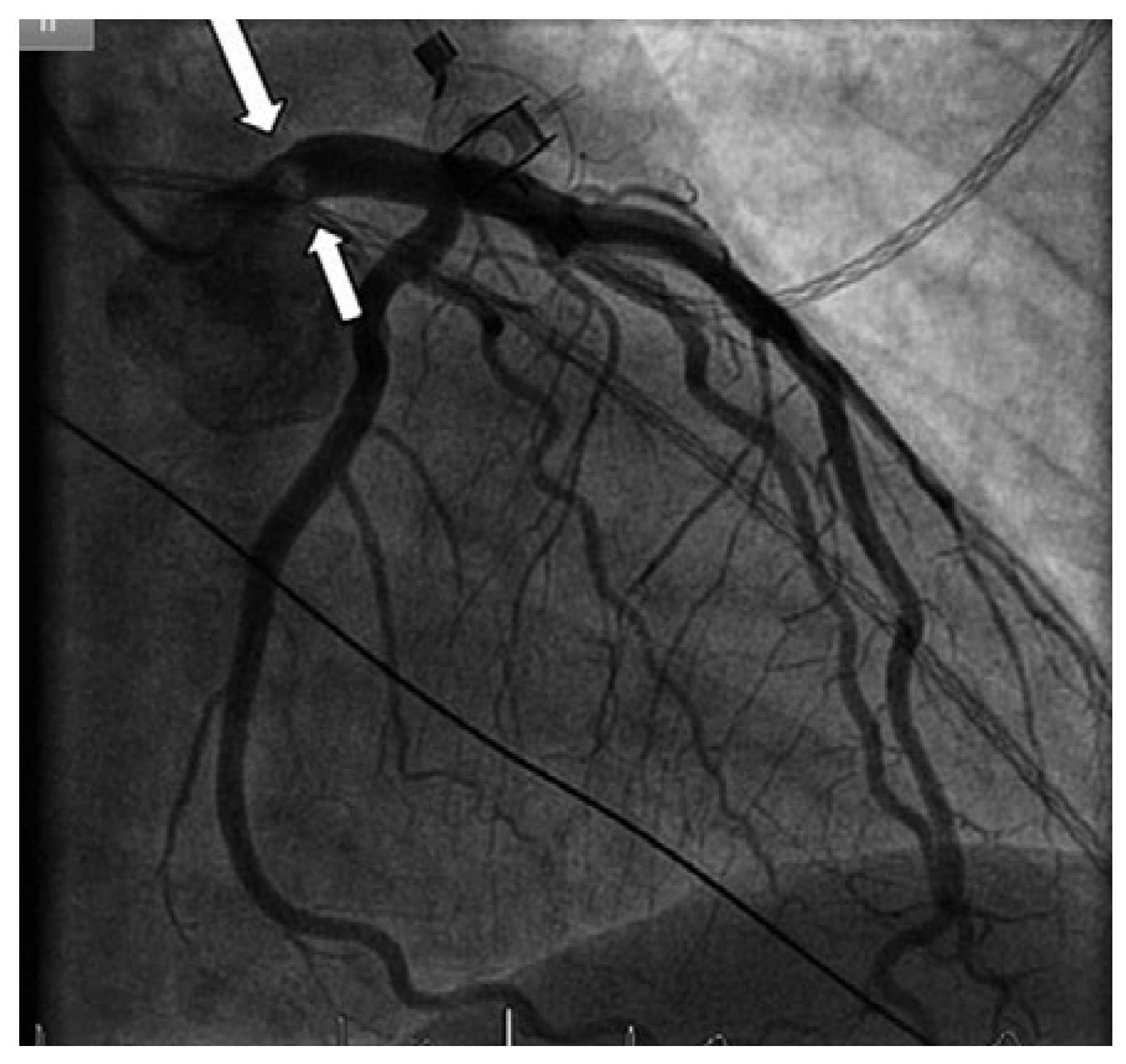 Cardiovascmed 21 00259 g002 Cardiovascmed 21 00259 g002
