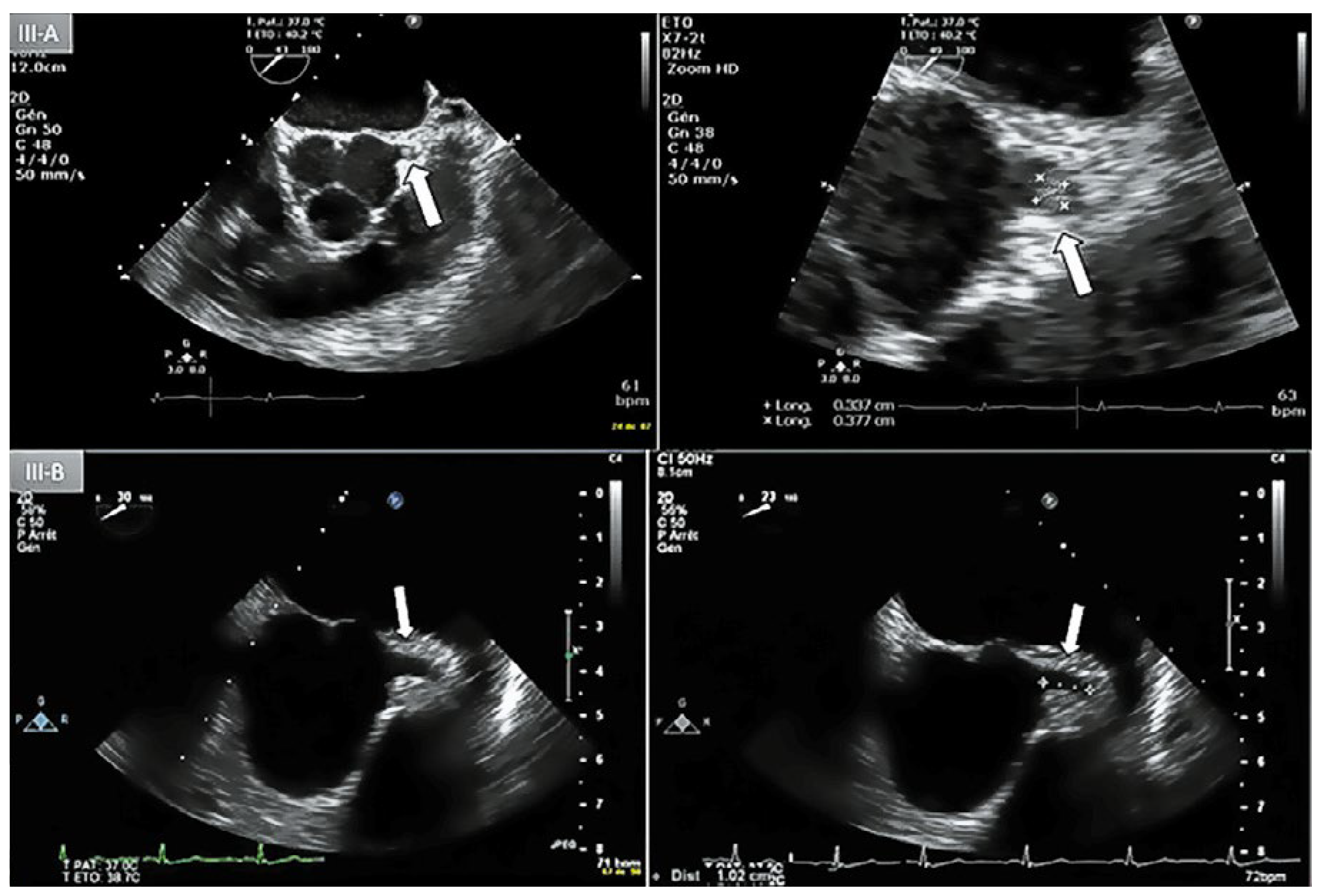 Cardiovascmed 21 00259 g003 Cardiovascmed 21 00259 g003