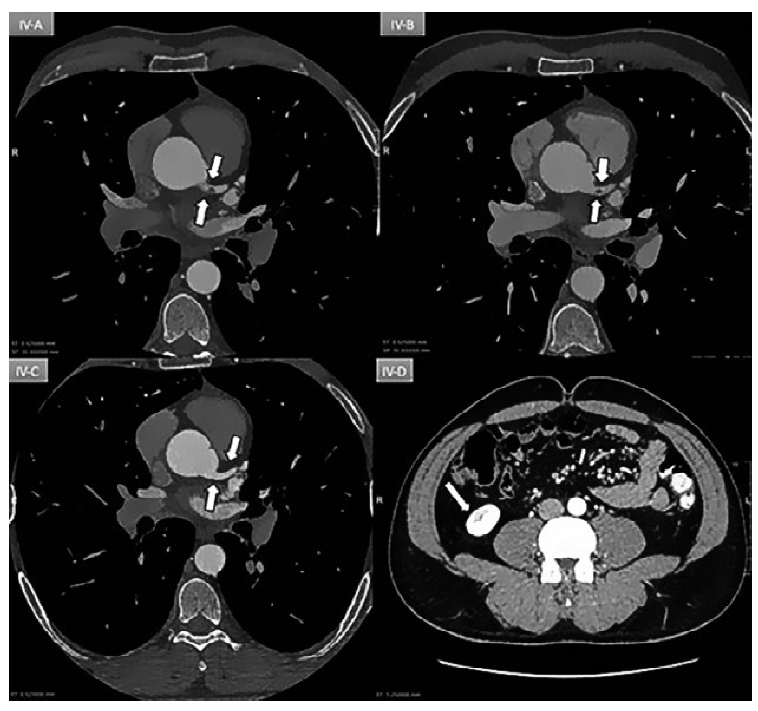 Cardiovascmed 21 00259 g004 Cardiovascmed 21 00259 g004