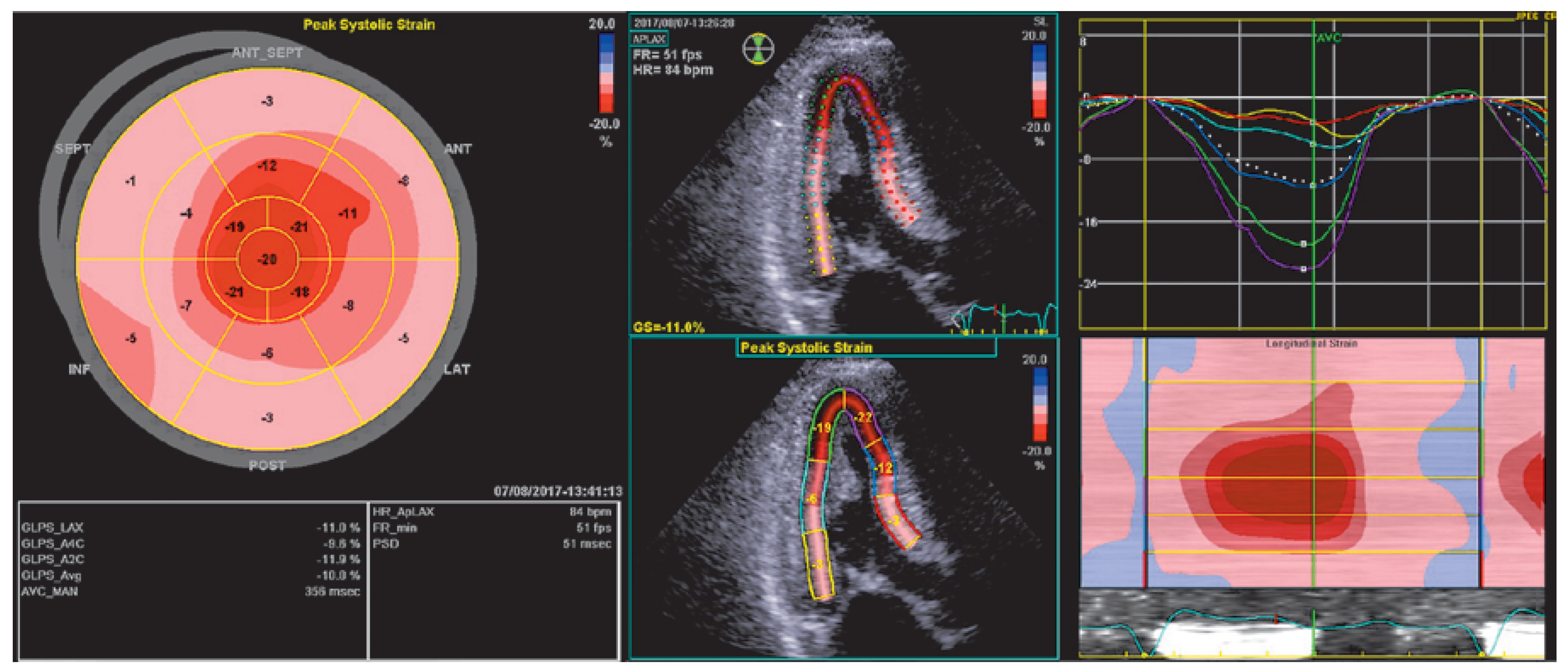 Cardiovascmed 21 00282 g004