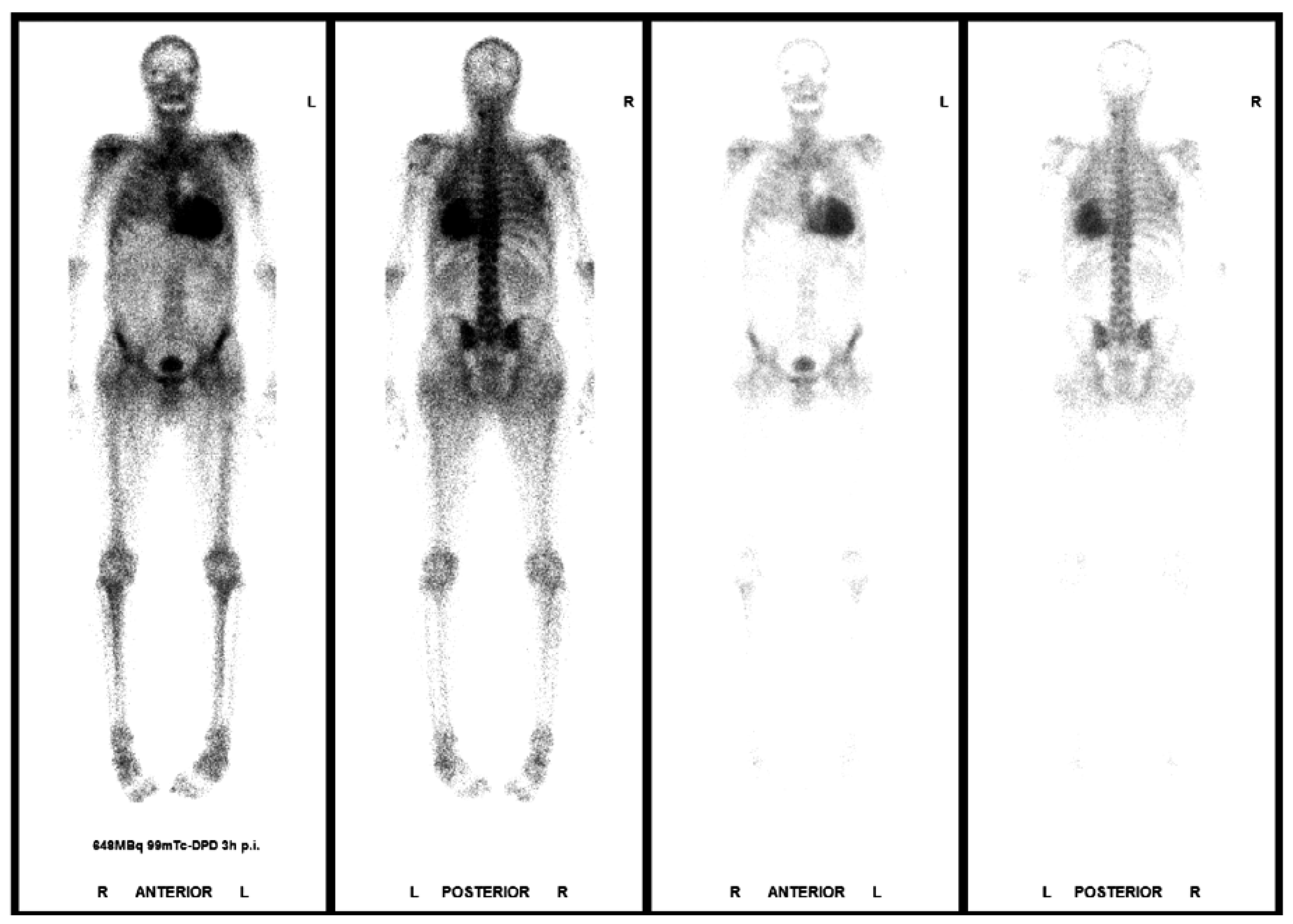 Cardiovascmed 21 00282 g007