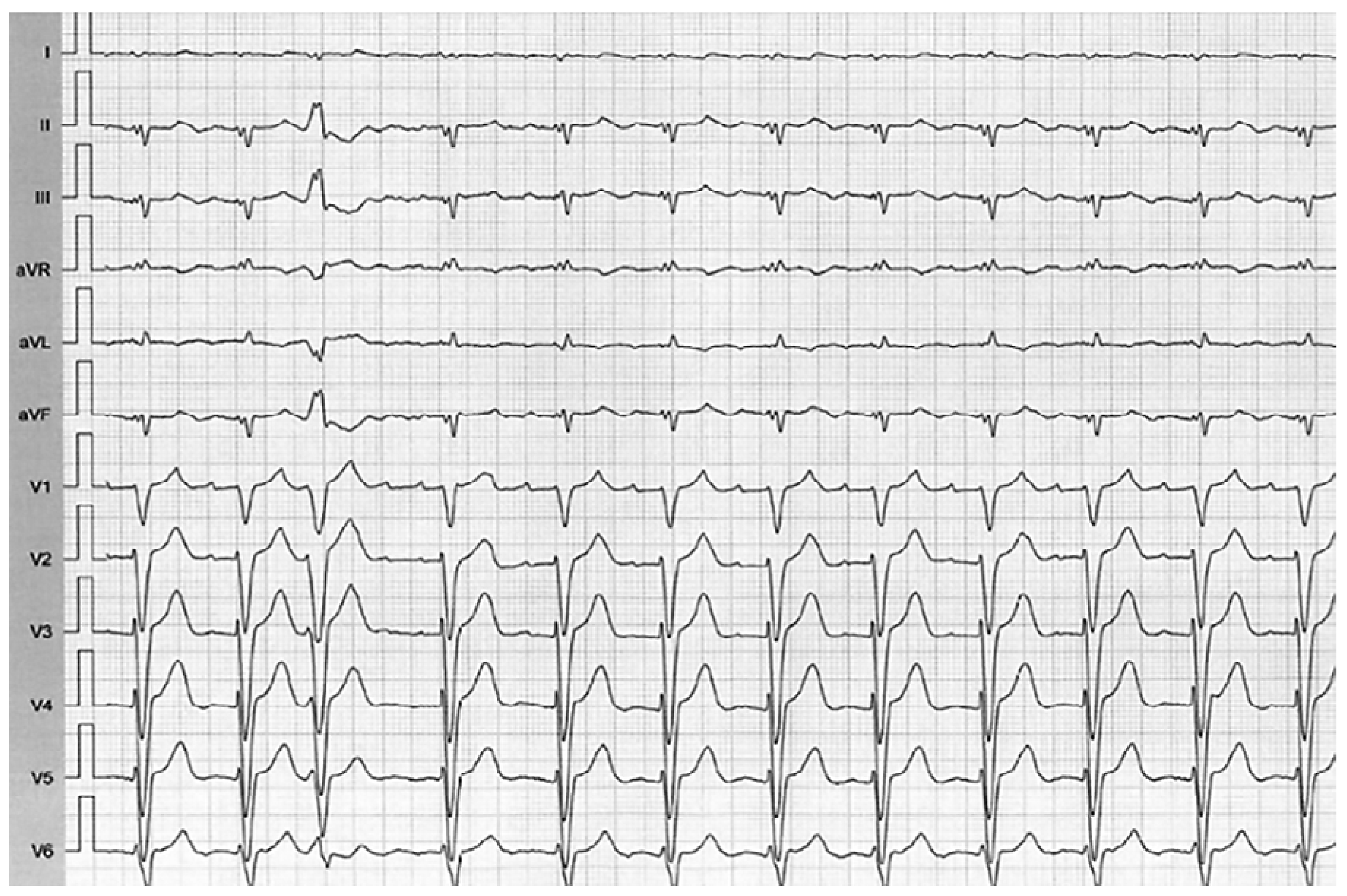Cardiovascmed 21 00296 g001