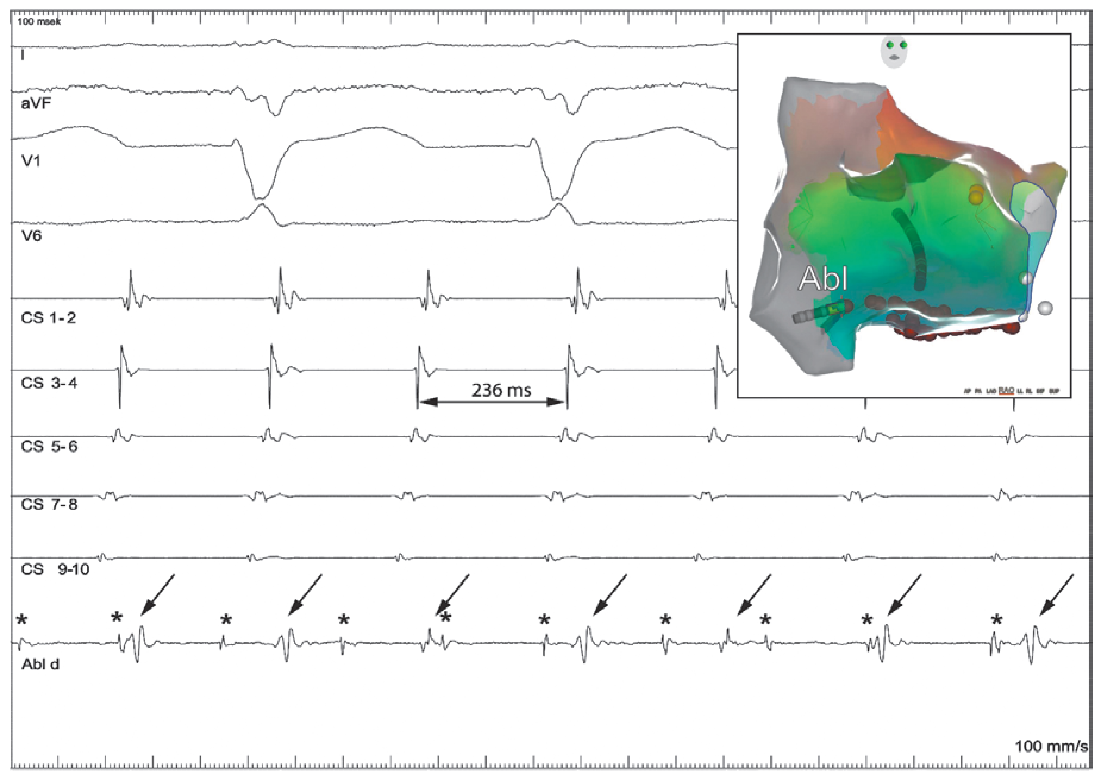 Cardiovascmed 21 00296 g002