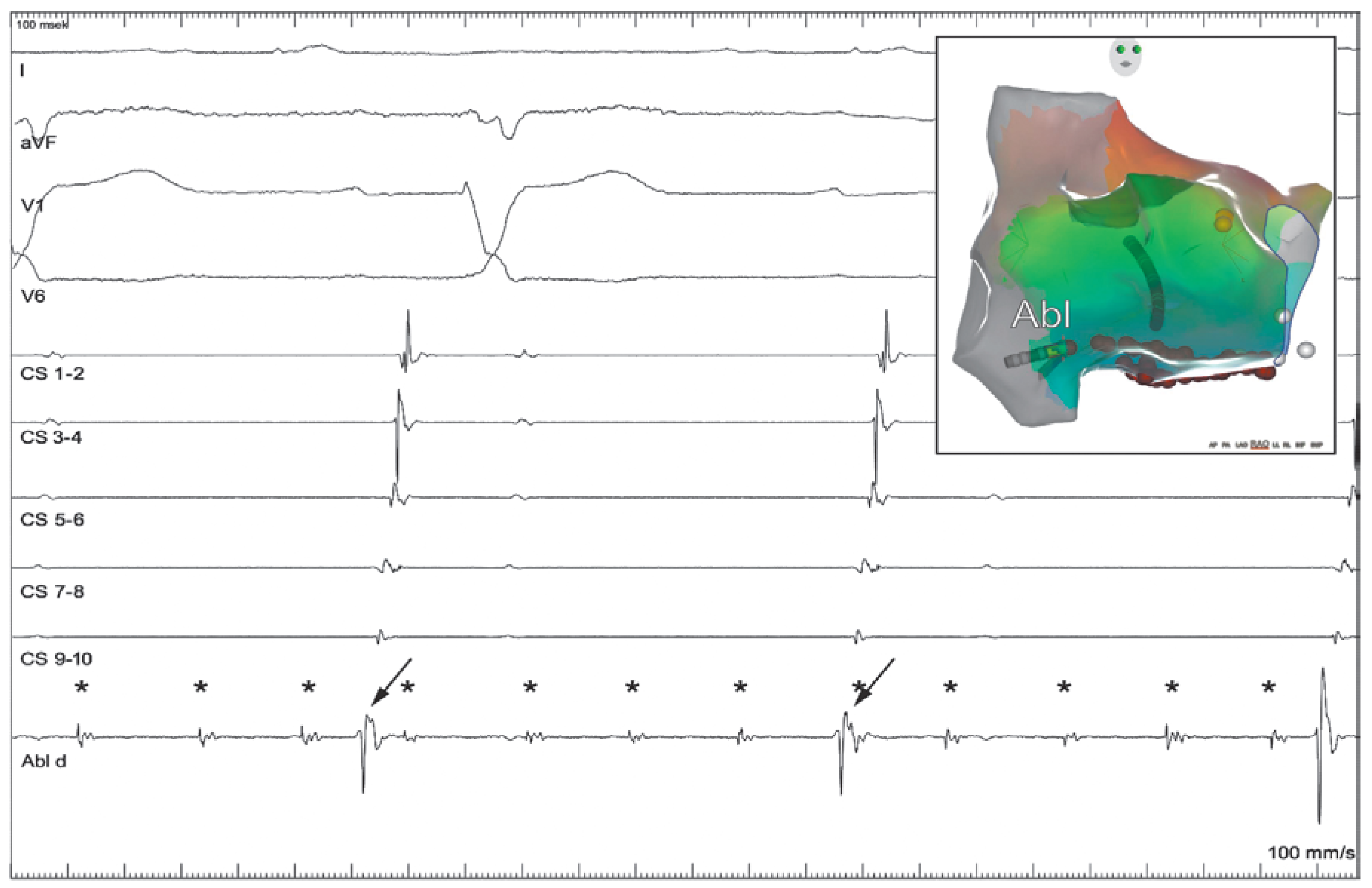 Cardiovascmed 21 00296 g003