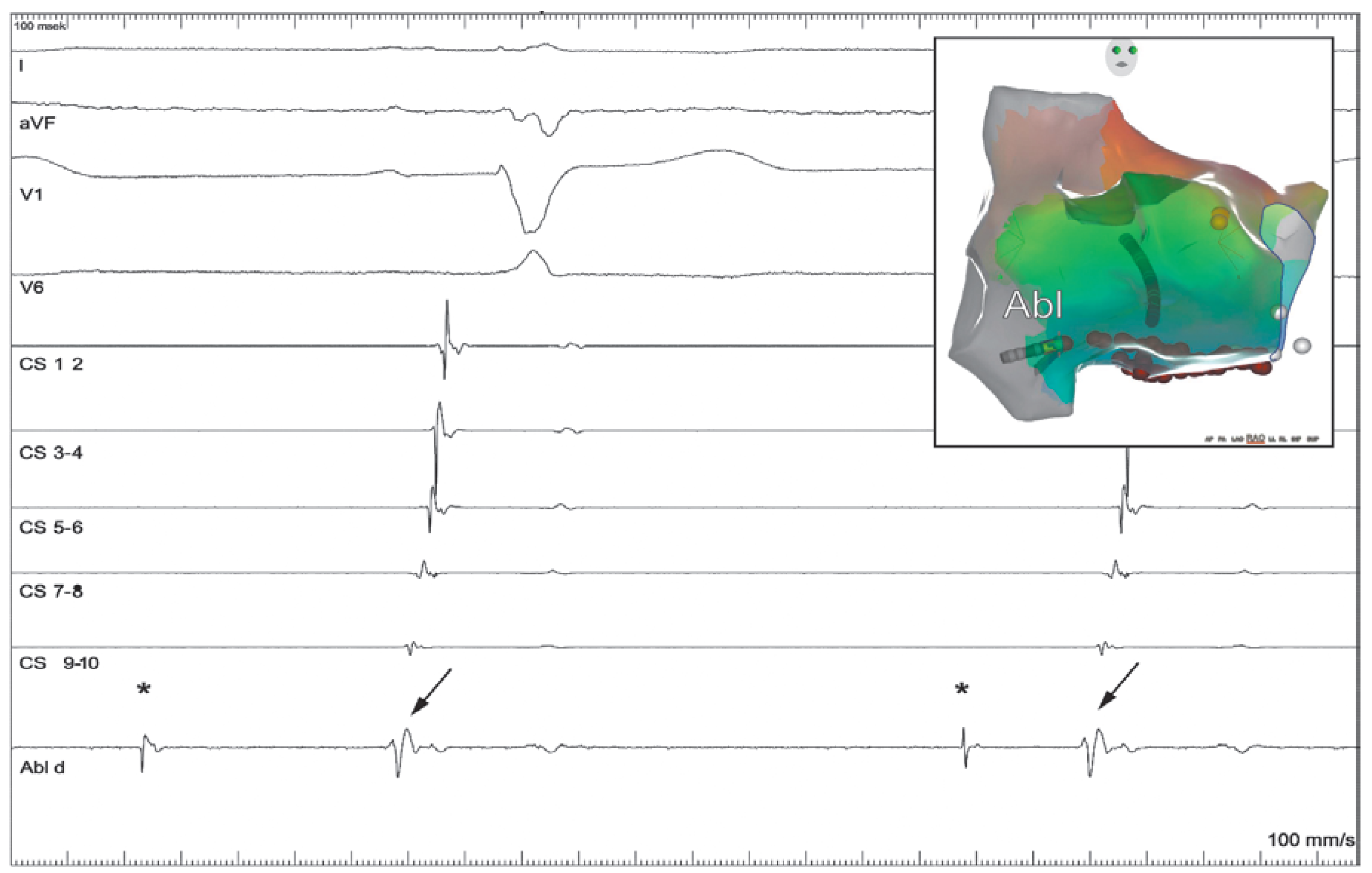 Cardiovascmed 21 00296 g004