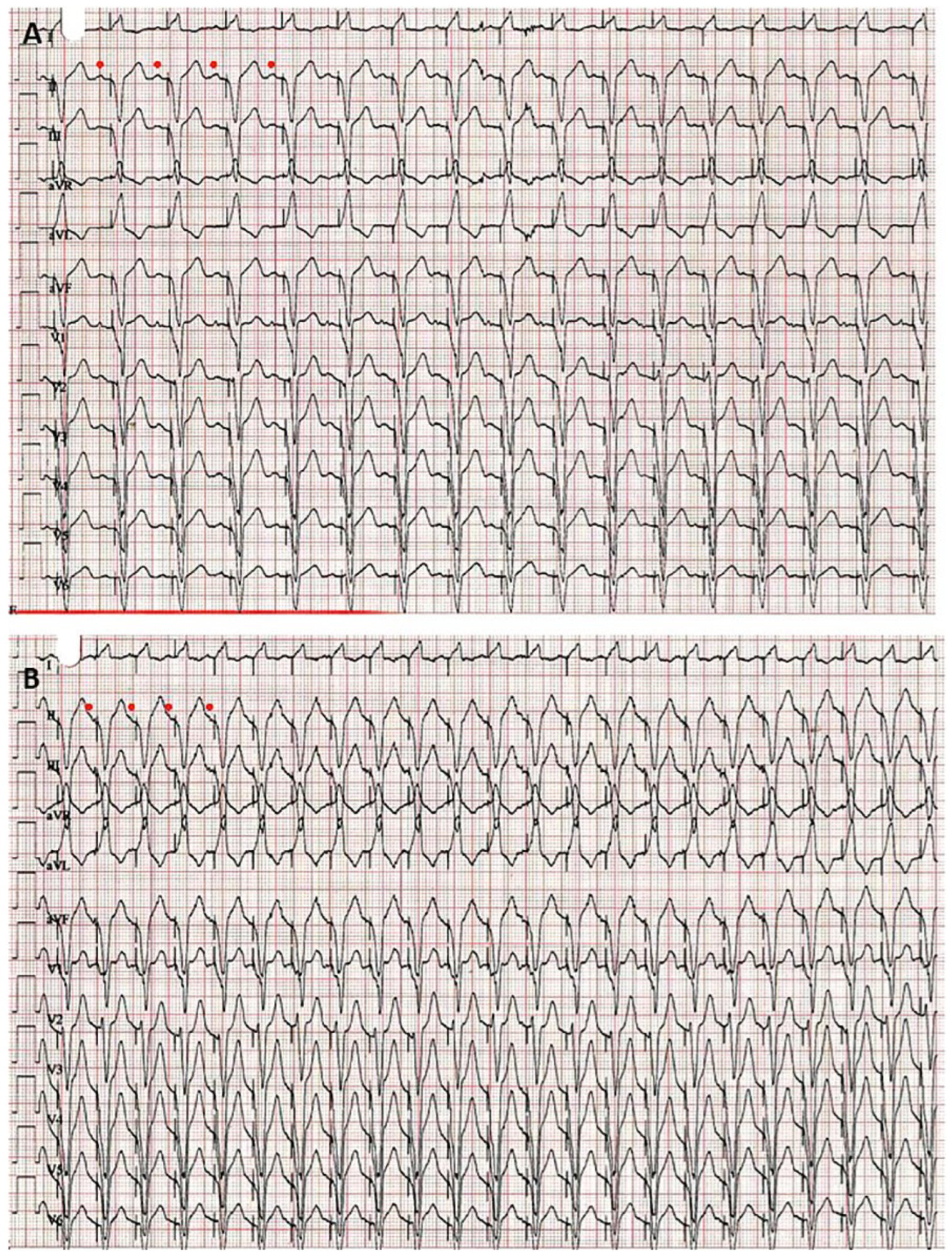 Cardiovascmed 21 00322 g003
