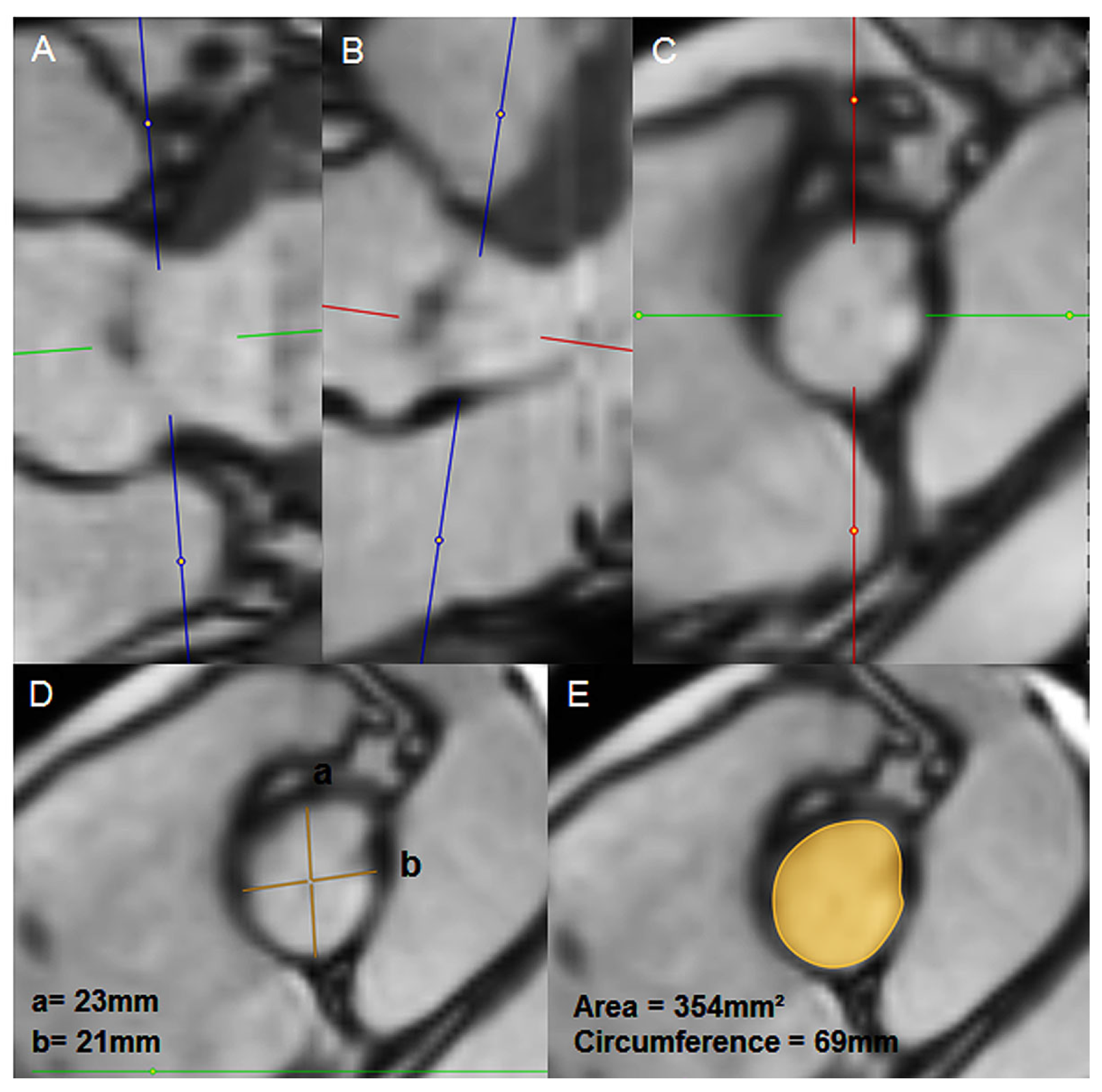 Cardiovascmed 22 w02021 g001