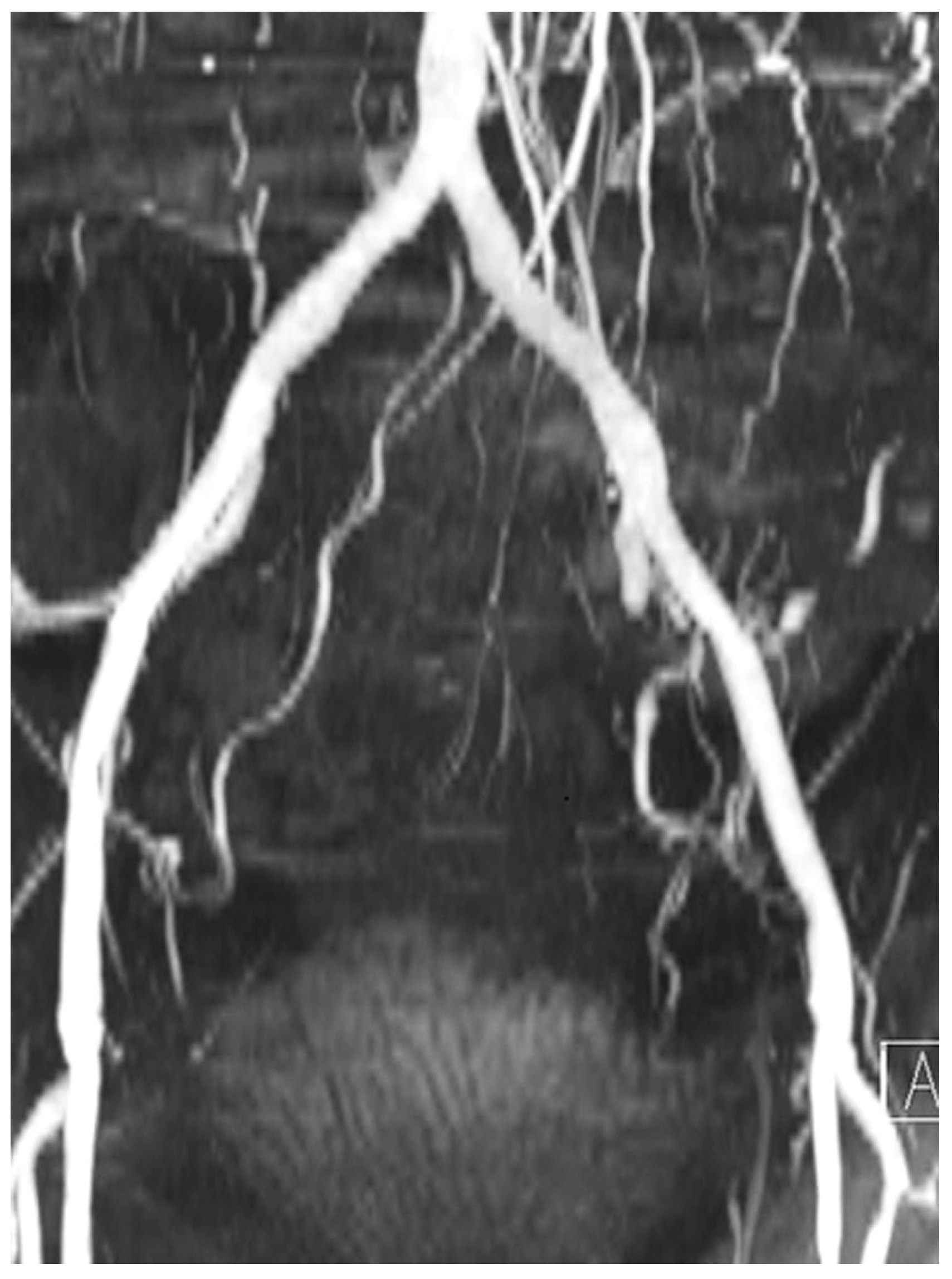 Cardiovascmed 22 w02021 g002