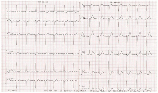 Cardiovascmed 24 02182 g001