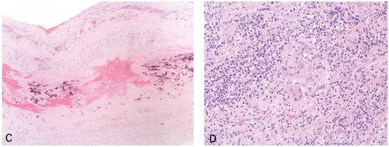 Cardiovascmed 24 02182 g002