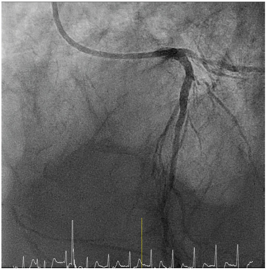 Cardiovascmed 24 02184 g004
