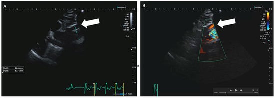 Cardiovascmed 24 w02135 g001