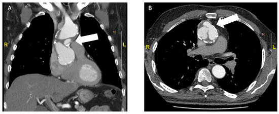 Cardiovascmed 24 w02135 g002