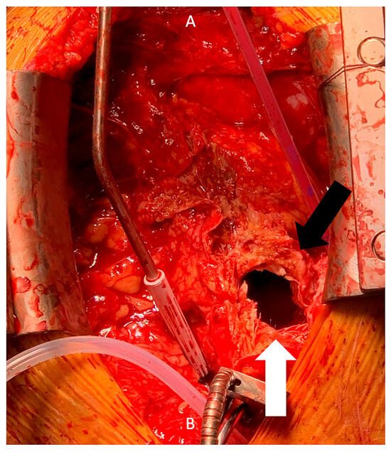 Cardiovascmed 24 w02135 g003