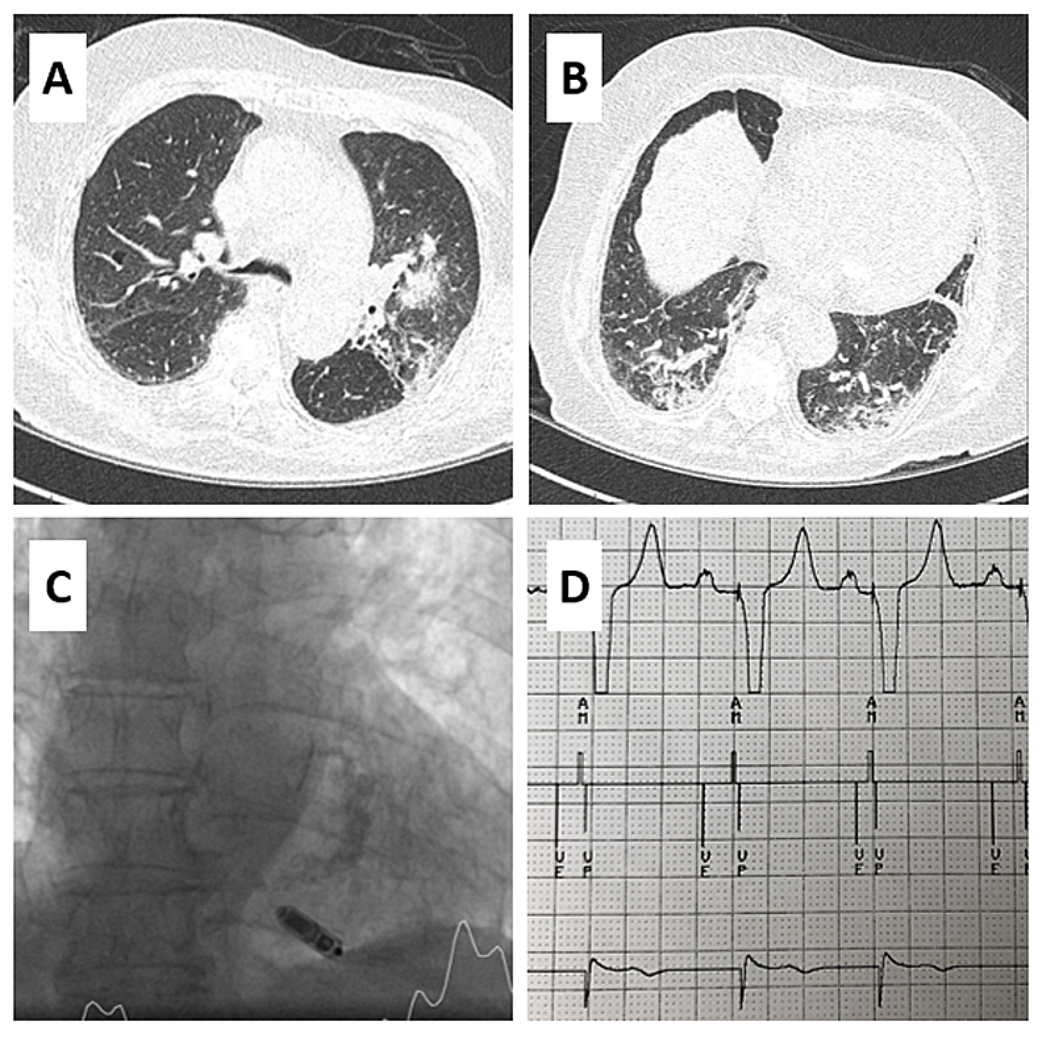 Cardiovascmed 25 00001 g001 Cardiovascmed 25 00001 g001