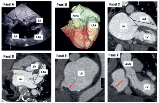 Cardiovascmed 25 00100 g001