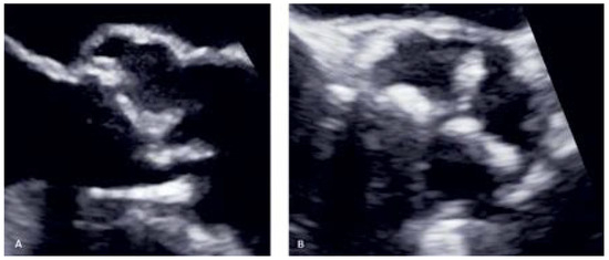 Cardiovascmed 25 00116 g001