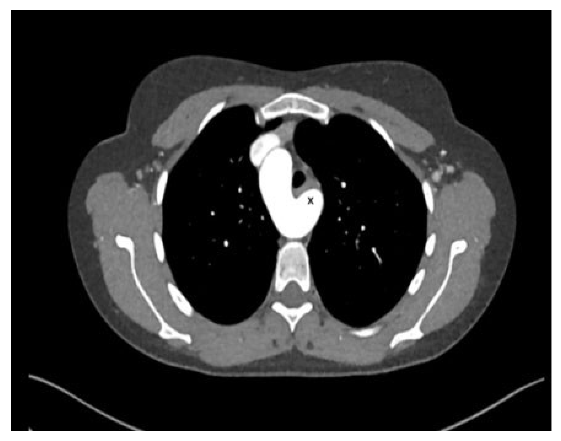 Cardiovascmed 25 00143 g001 Cardiovascmed 25 00143 g001