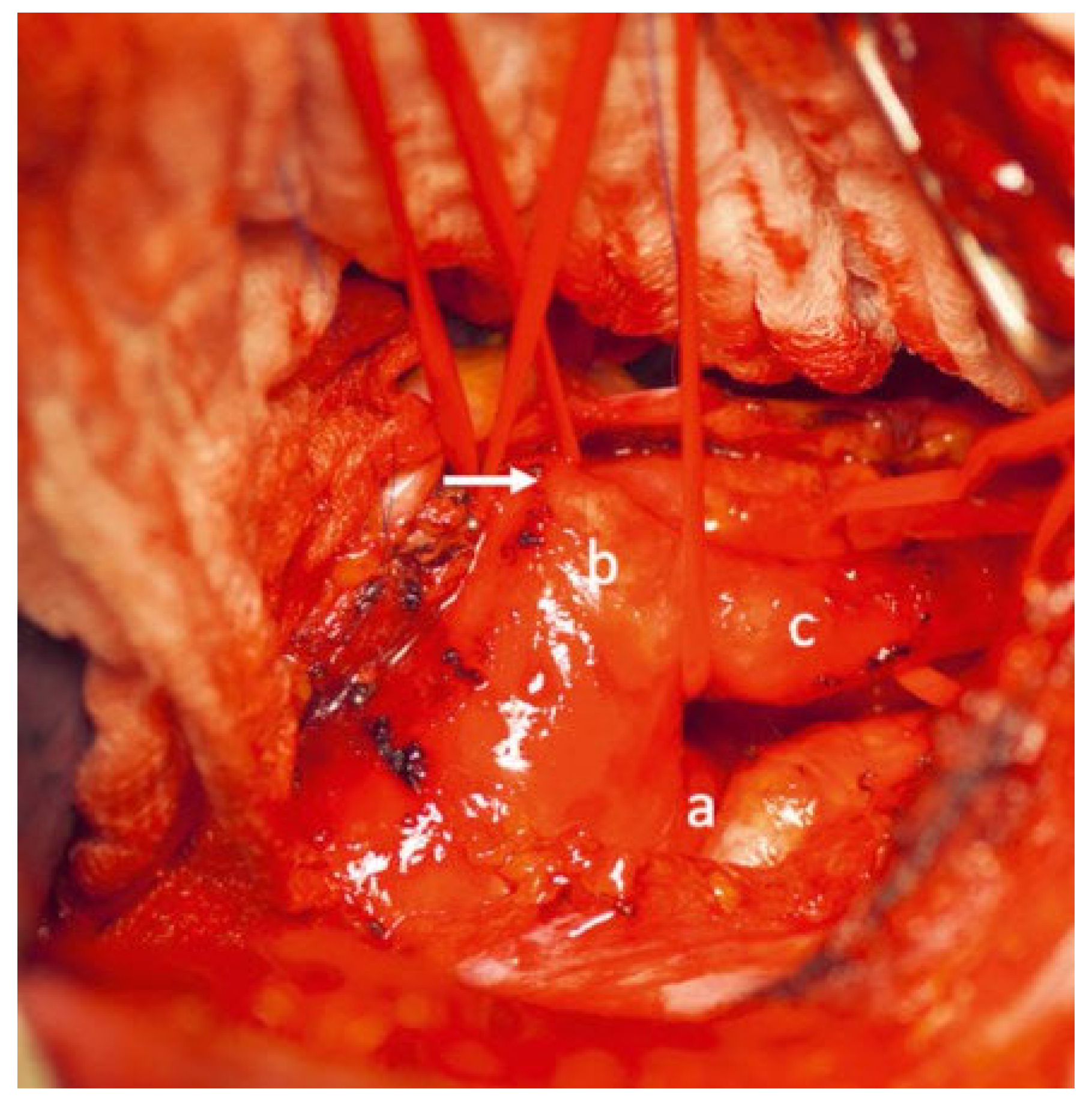Cardiovascmed 25 00143 g002 Cardiovascmed 25 00143 g002