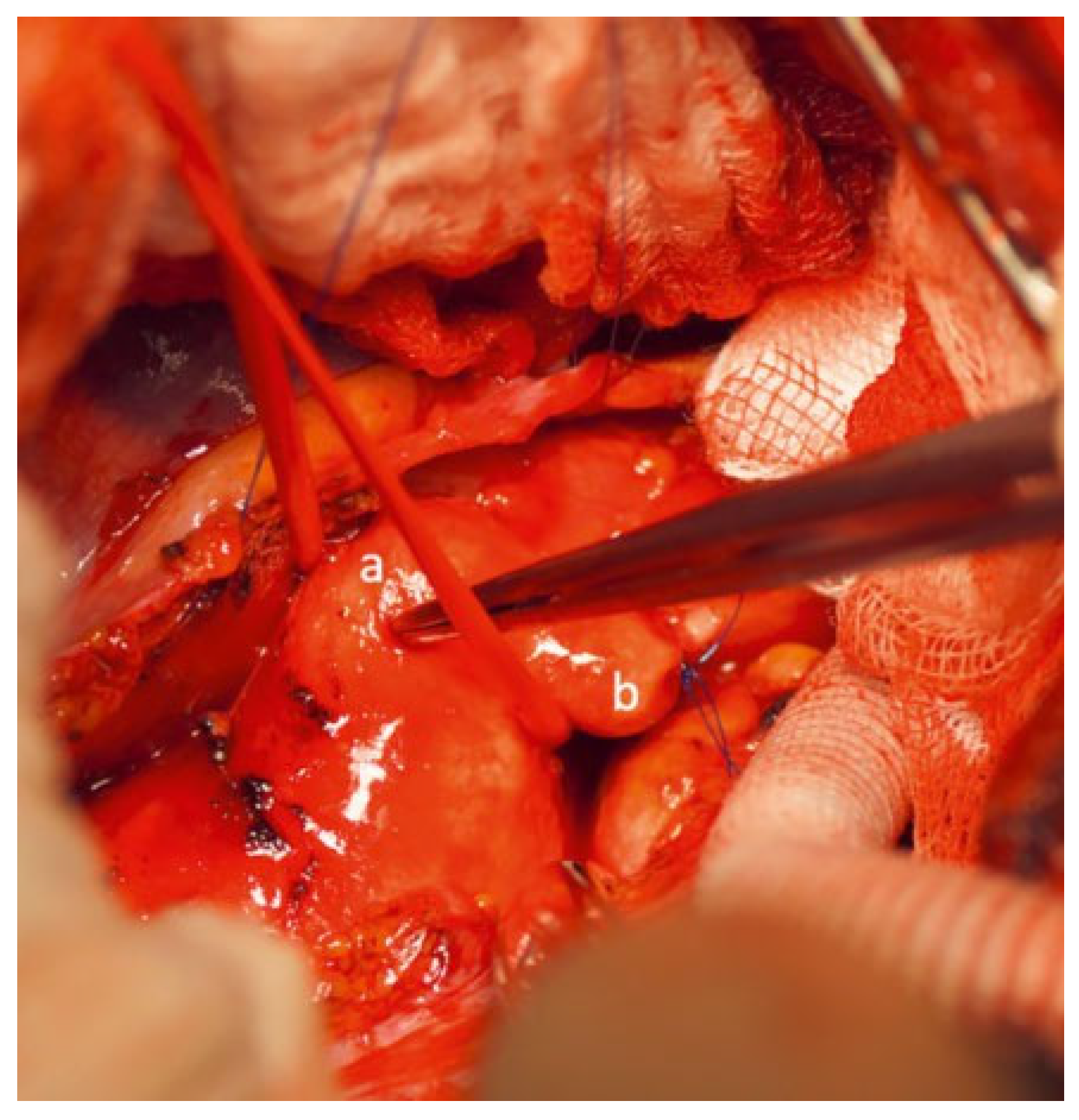 Cardiovascmed 25 00143 g003 Cardiovascmed 25 00143 g003