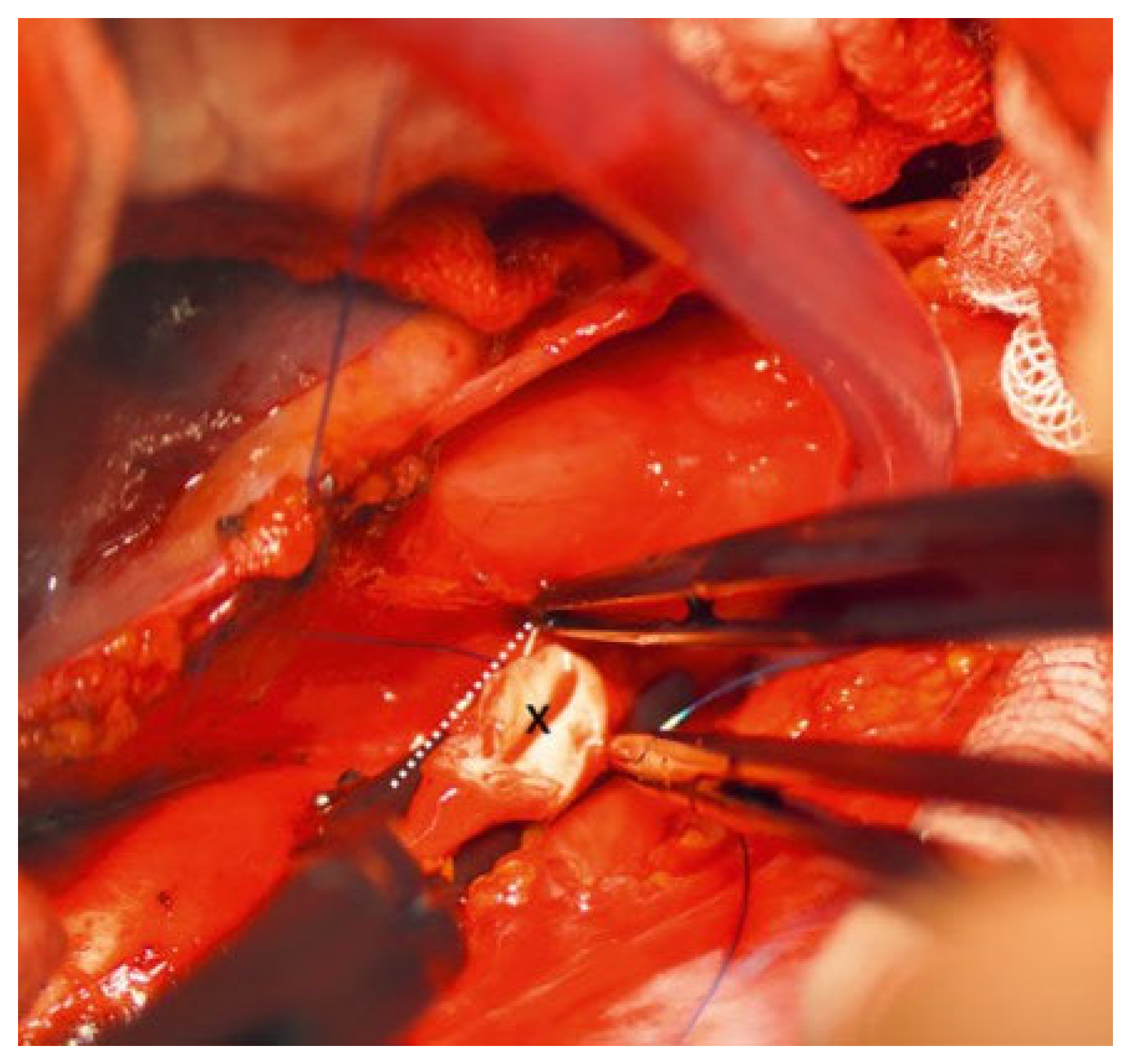 Cardiovascmed 25 00143 g004 Cardiovascmed 25 00143 g004