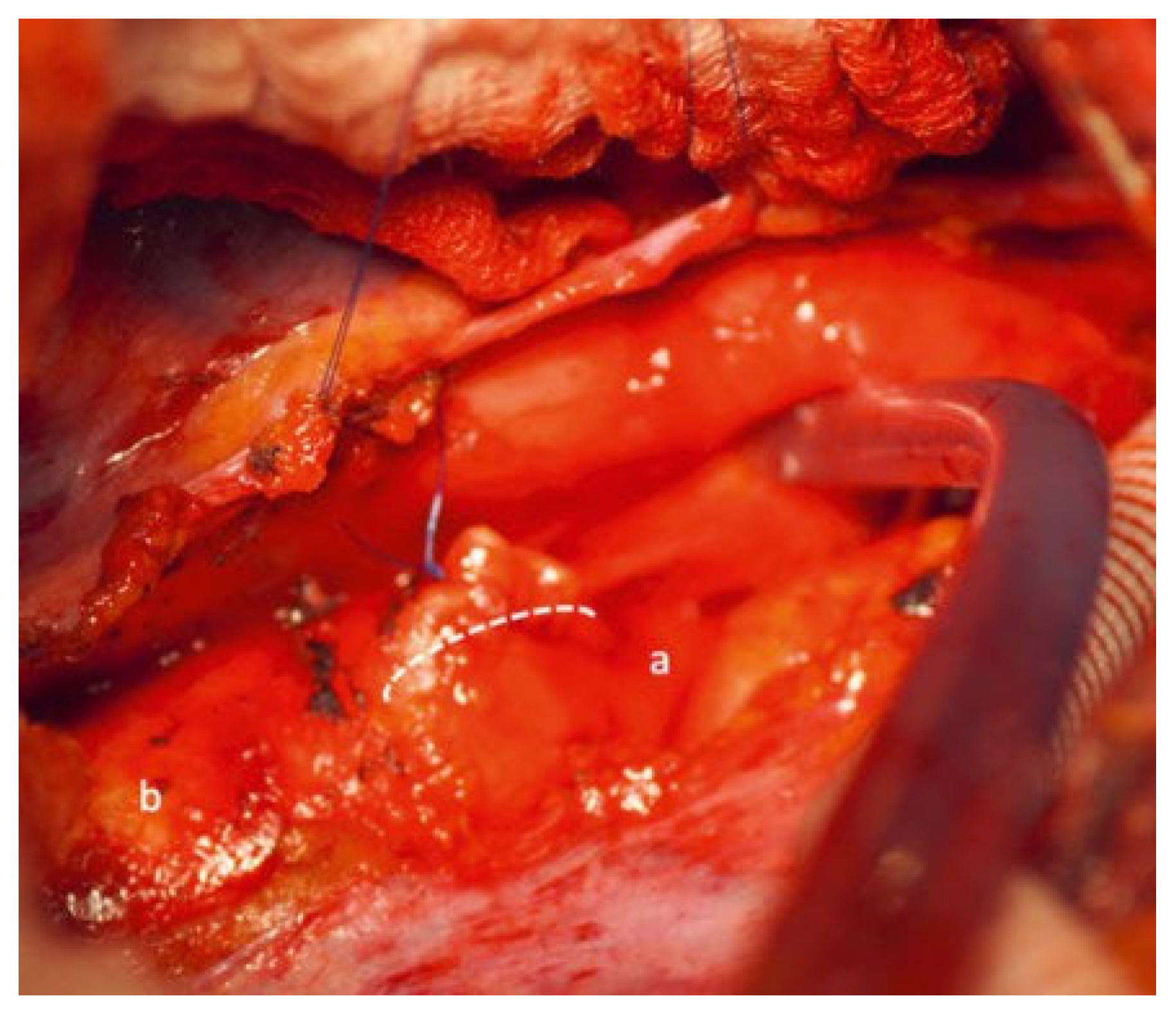 Cardiovascmed 25 00143 g005 Cardiovascmed 25 00143 g005