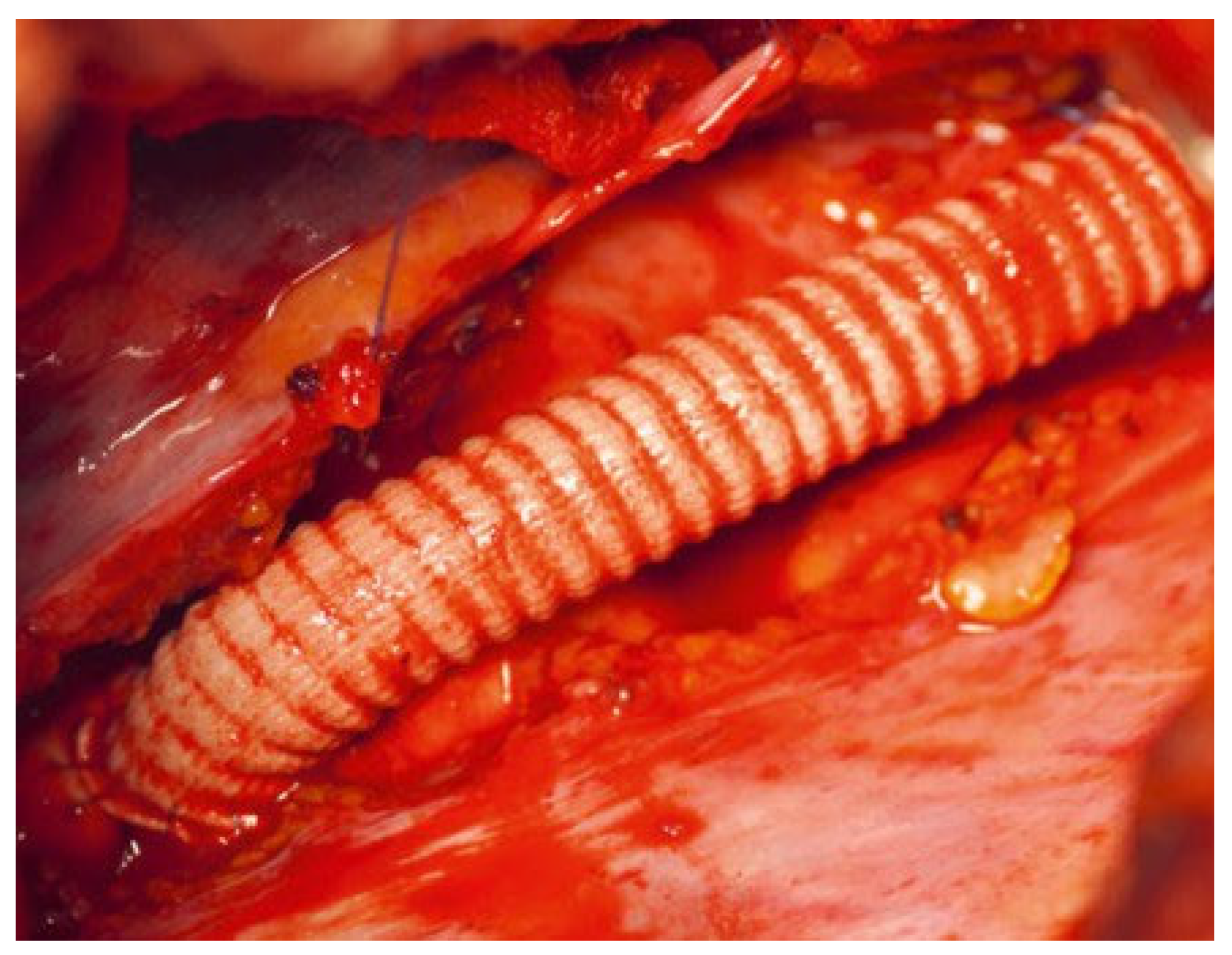 Cardiovascmed 25 00143 g006 Cardiovascmed 25 00143 g006