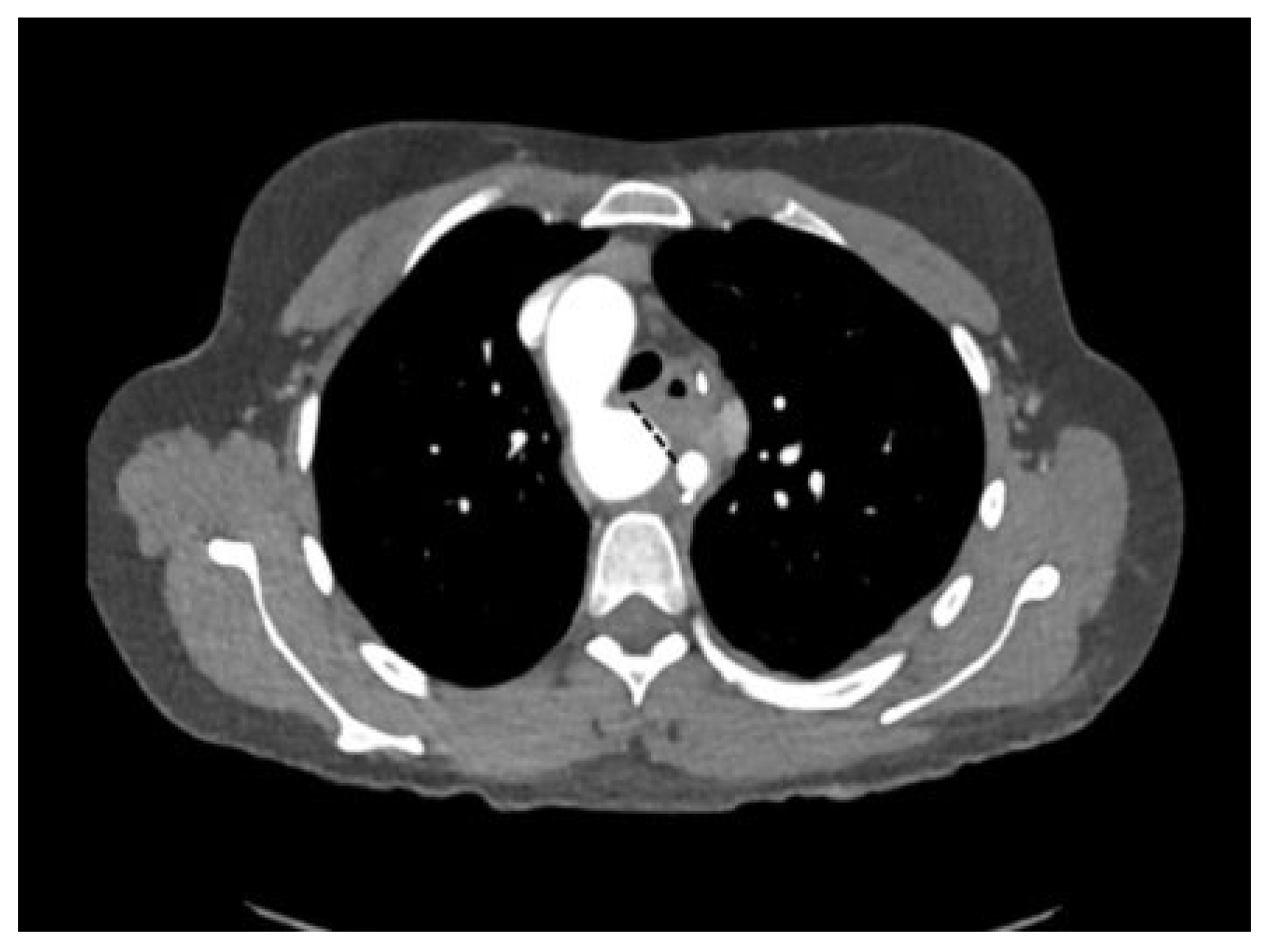 Cardiovascmed 25 00143 g007 Cardiovascmed 25 00143 g007