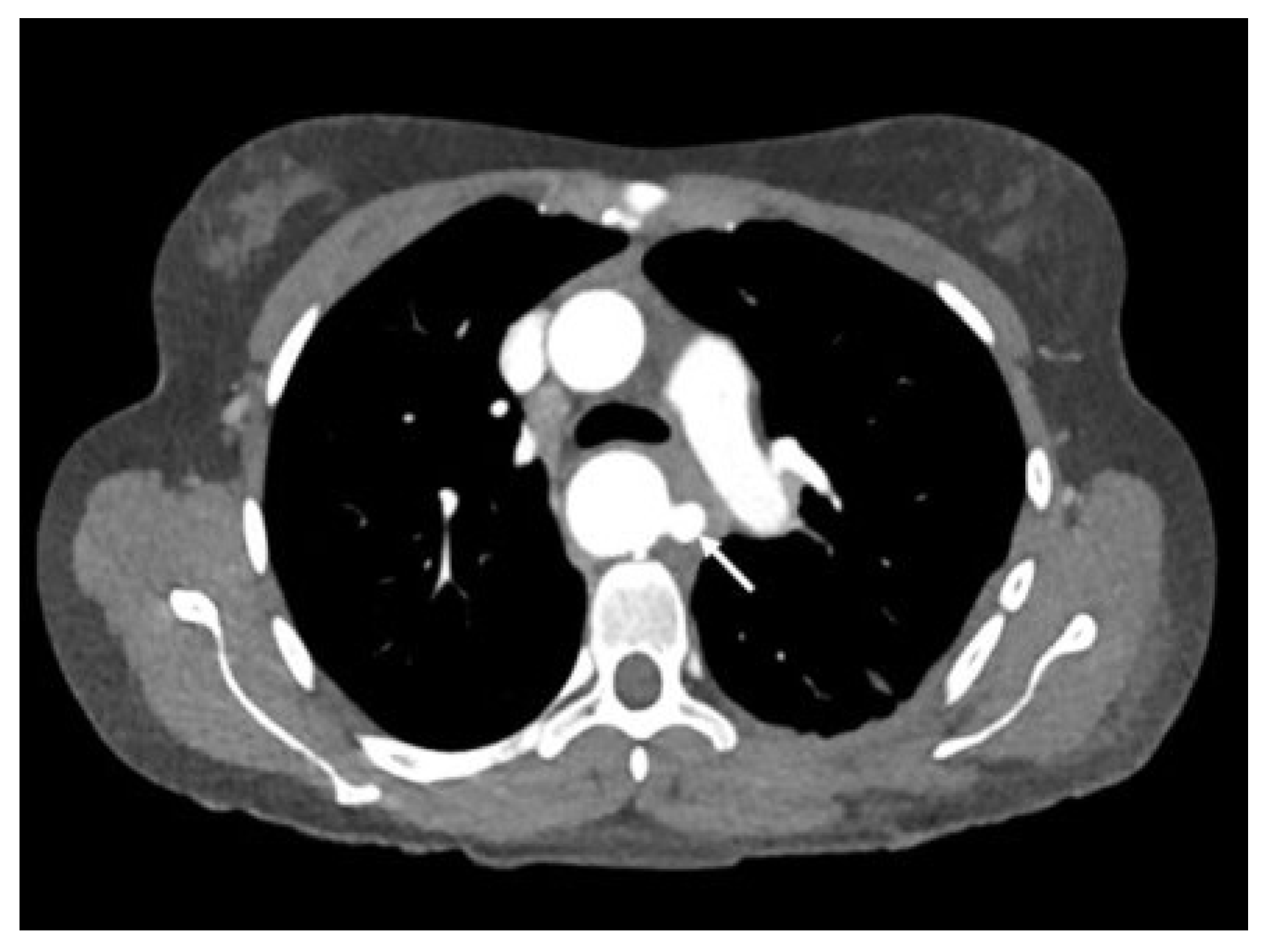 Cardiovascmed 25 00143 g008 Cardiovascmed 25 00143 g008