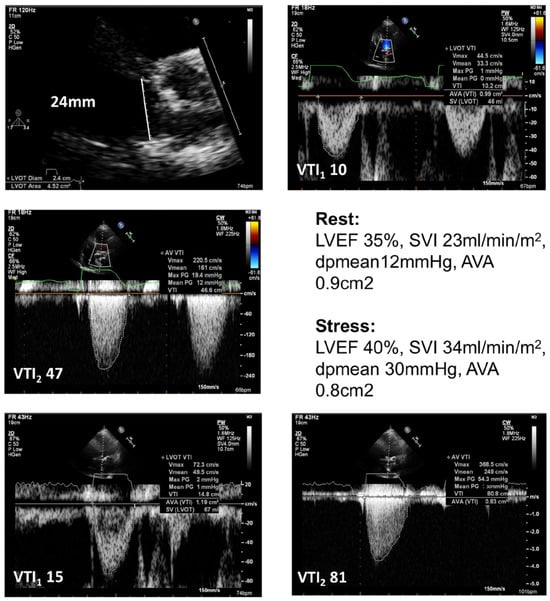 Cardiovascmed 25 00148 g001 Cardiovascmed 25 00148 g001