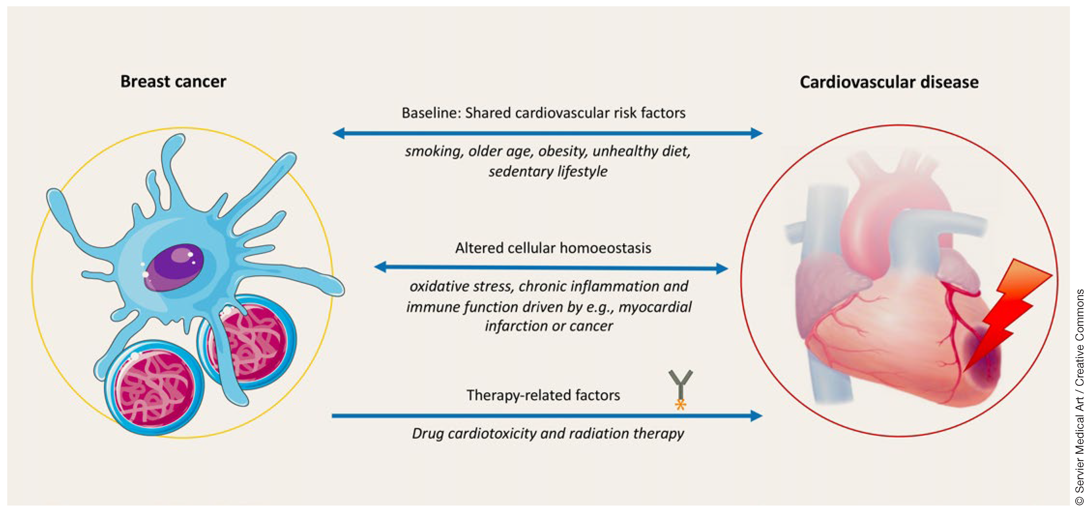 Cardiovascmed 26 00100 g003
