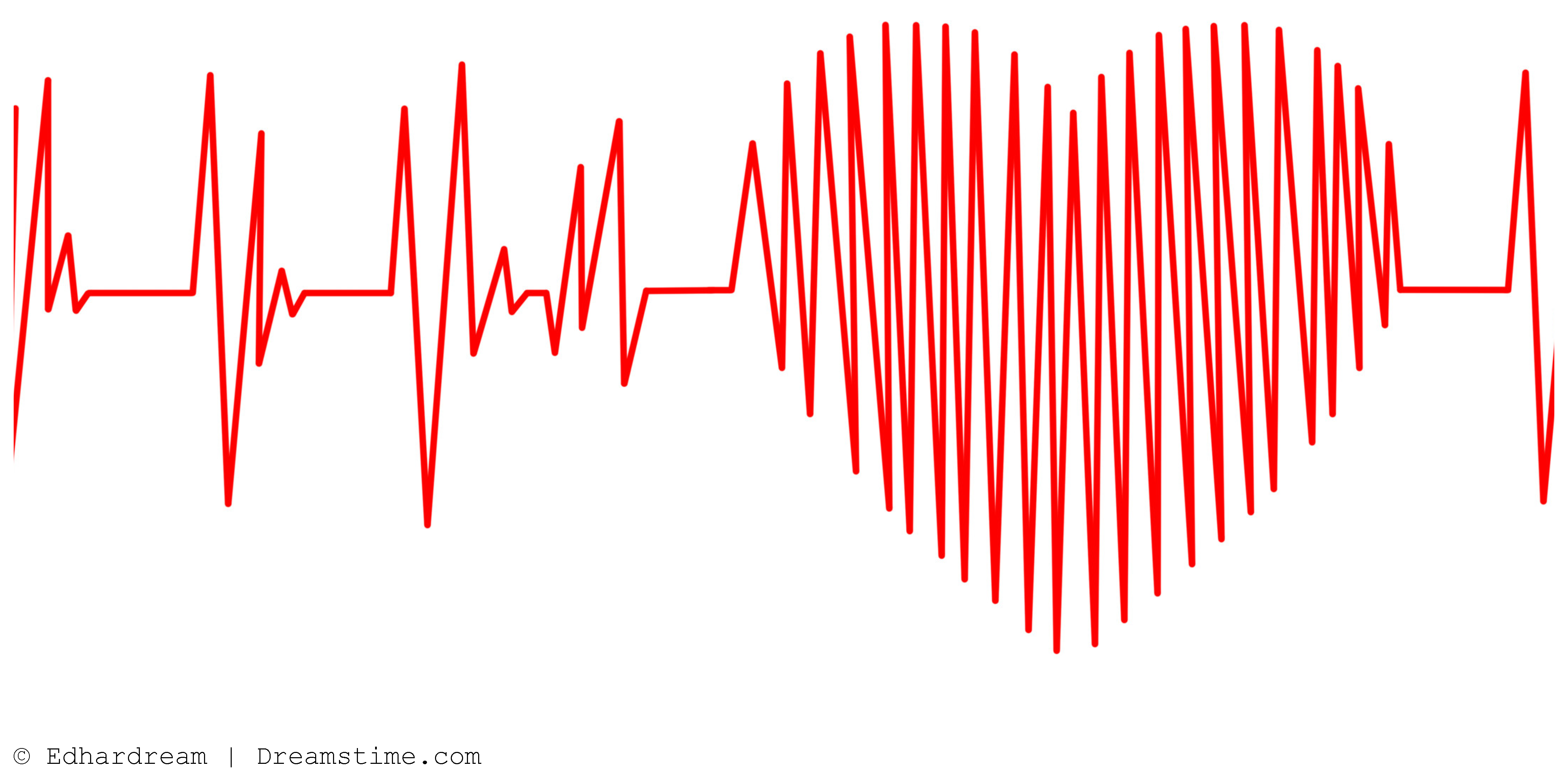 Cardiovascmed 26 00139 i001