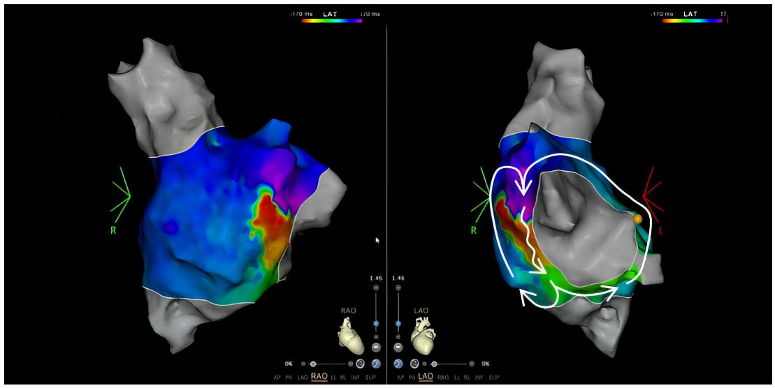 Cardiovascmed 26 00199 i001 Cardiovascmed 26 00199 i001