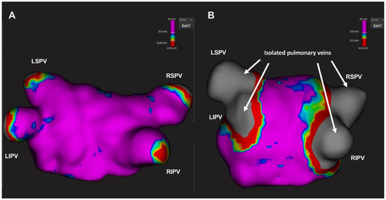 Cardiovascmed 27 00041 g004