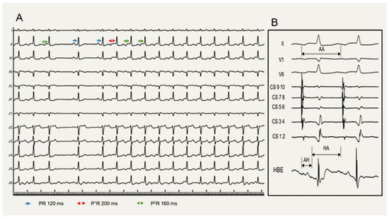Cardiovascmed 27 00122 g001
