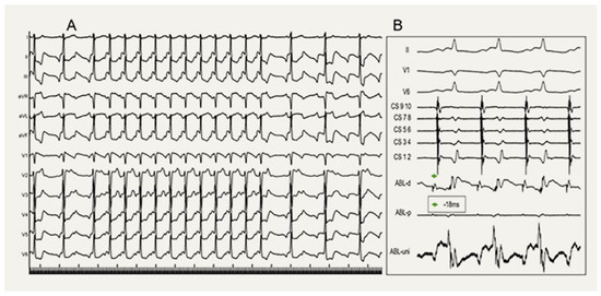 Cardiovascmed 27 00122 g002