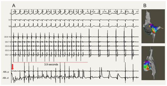 Cardiovascmed 27 00122 g003