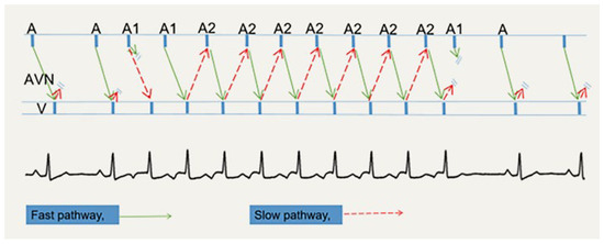 Cardiovascmed 27 00122 g004