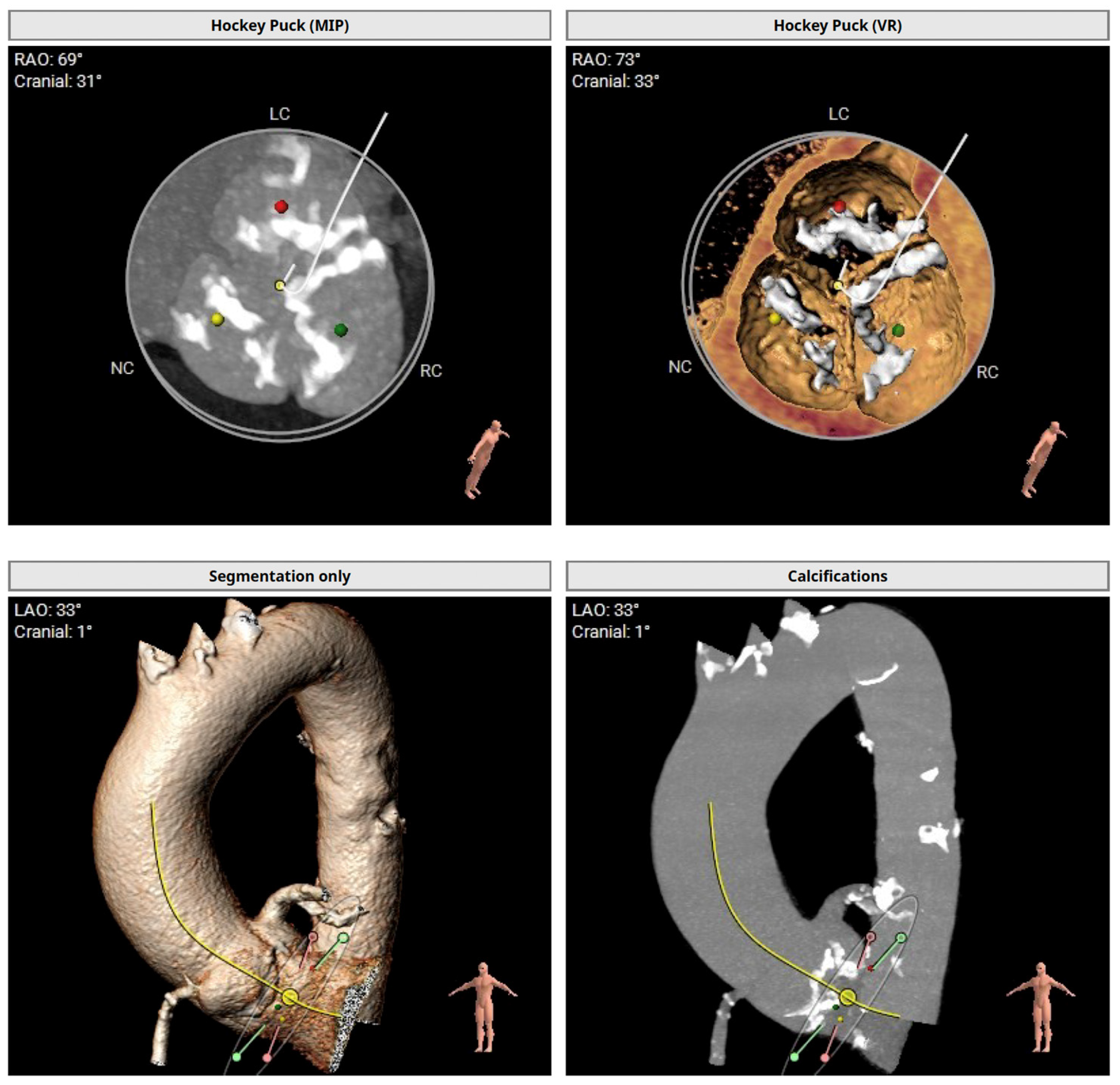 Cardiovascmed 28 00004 g001 Cardiovascmed 28 00004 g001