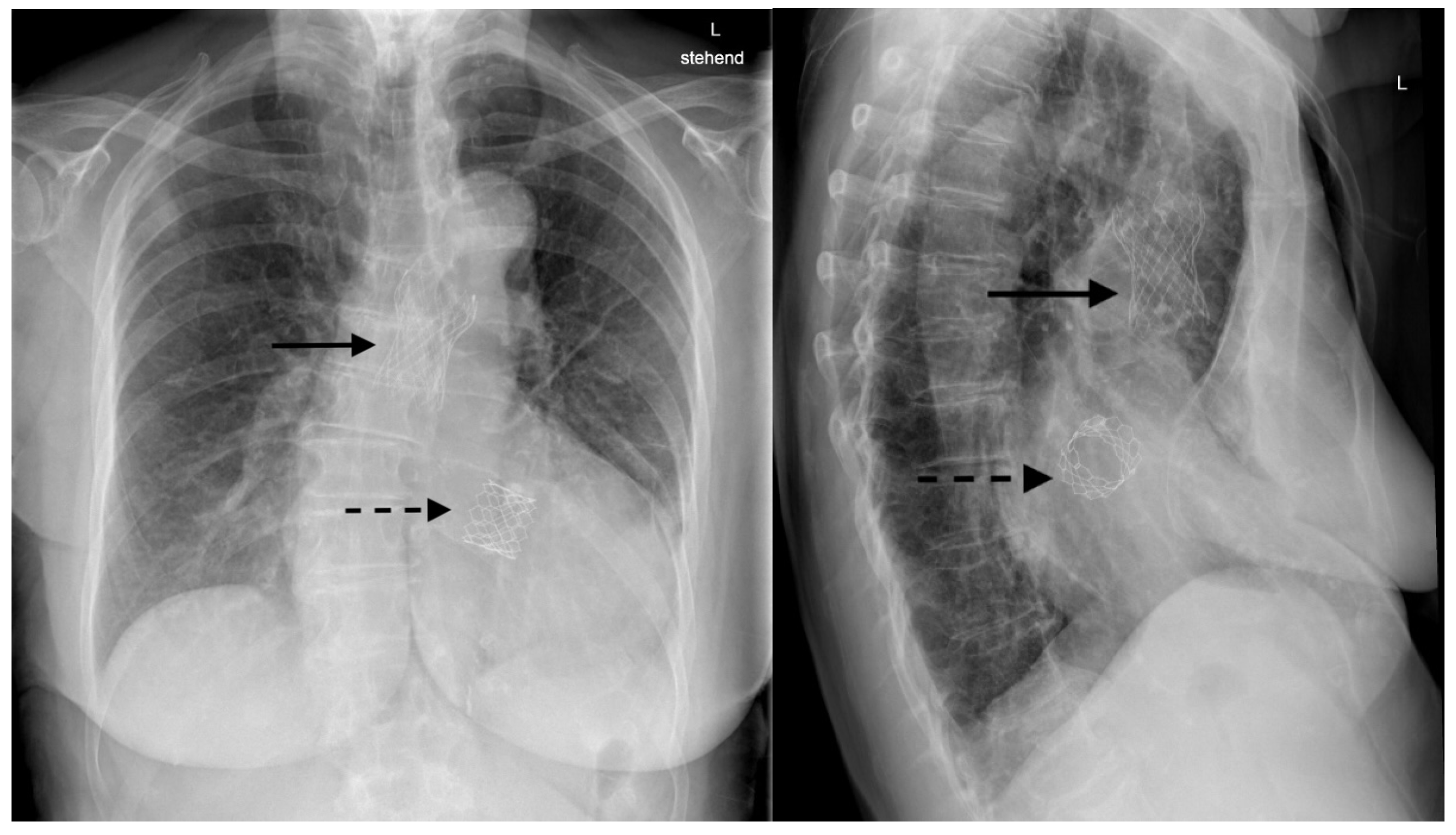 Cardiovascmed 28 00004 g002 Cardiovascmed 28 00004 g002