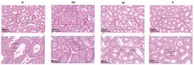 Histological observation of testicular tissue of sheep at different stages of development. ST: seminiferous tubules; Primary SPC: Primary Spermatocyte; Secondary SPC: Secondary Spermatocyte; SCs: Sertoli Cell.