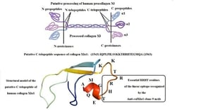 The amino acid sequence of the putative extracellular processed form of human collagen XIα1 (residues 512 to 1563 of the P12107-1 A isoform), recombinantly expressed in CHO cells (provided by GenScript). It encompasses the C-terminal telopeptide—(1543) IQPLPILSSKKTRRHTEGMQA (1563)—sequence. It is preceded by the MGWSCIILFLVATATGVHS signal peptide and a 6xHis head.