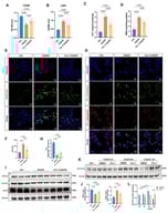 OGD/R modeling in AC16 cells and the effects of Fer-1 on injury and ferroptosis. (A,B) Cell viability and membrane integrity: CCK-8 and LDH release (n = 3 independent experiments). (C,D) Iron and lipid peroxidation: intracellular Fe2+ and MDA (n = 3 independent experiments). (E,F) Intracellular ROS: DCFH-DA imaging and quantification (n = 3 independent experiments). (G,H) ΔΨm: JC-1 imaging showing red J-aggregates (high ΔΨm) vs. green J-monomers (low ΔΨm); red/green ratio (n = 4 independent experiments). (I–L) Immunoblots of ACSL4, GPX4, and SLC7A11 at indicated reperfusion times; β-actin loading control; densitometry (n = 3 independent experiments). Data are presented as mean ± SD. One-way ANOVA with Tukey’s post hoc test; exact p values in the figure.