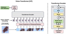 Vision Transformer (ViT) architecture for skin lesion classification. The input dermoscopic image is divided into non-overlapping patches, which are linearly projected into embeddings and combined with positional and class embeddings. The resulting token sequence is processed by a stack of transformer encoder blocks, and the final representation is fed to an MLP head to perform binary classification (melanoma vs. non-melanoma).